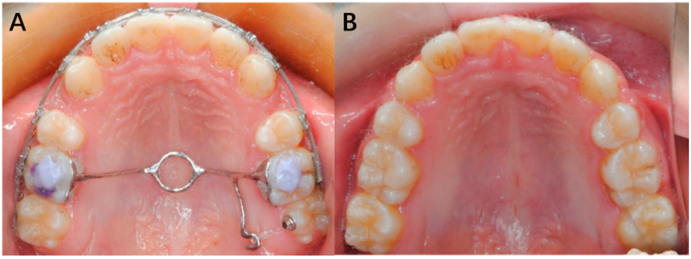 Applsci 12 07497 g008 Applsci 12 07497 g008