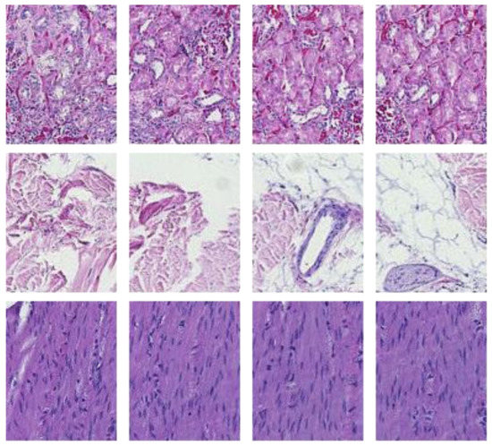 H&E Multi-Laboratory Staining Variance Exploration with Machine Learning