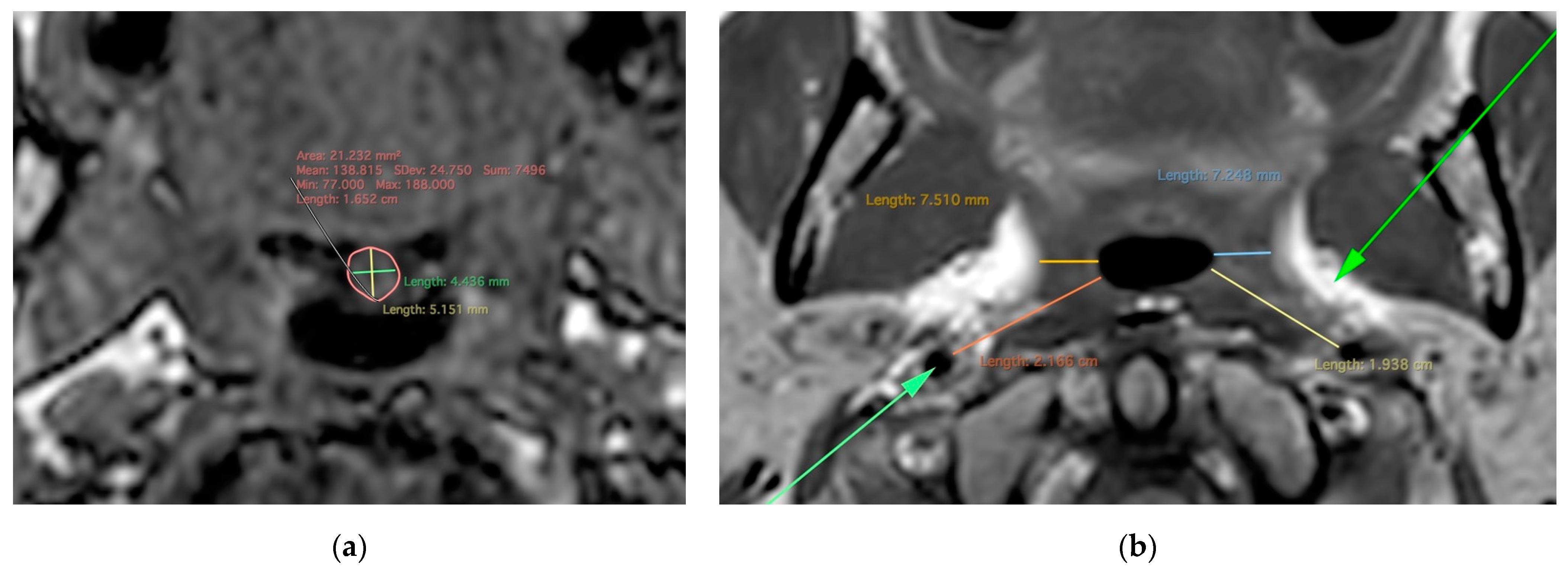 Applsci 12 07646 g004 Applsci 12 07646 g004