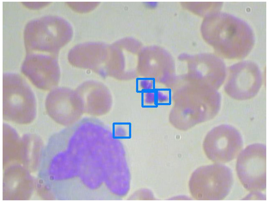 Complete Blood Cell Detection and Counting Based on Deep Neural Networks