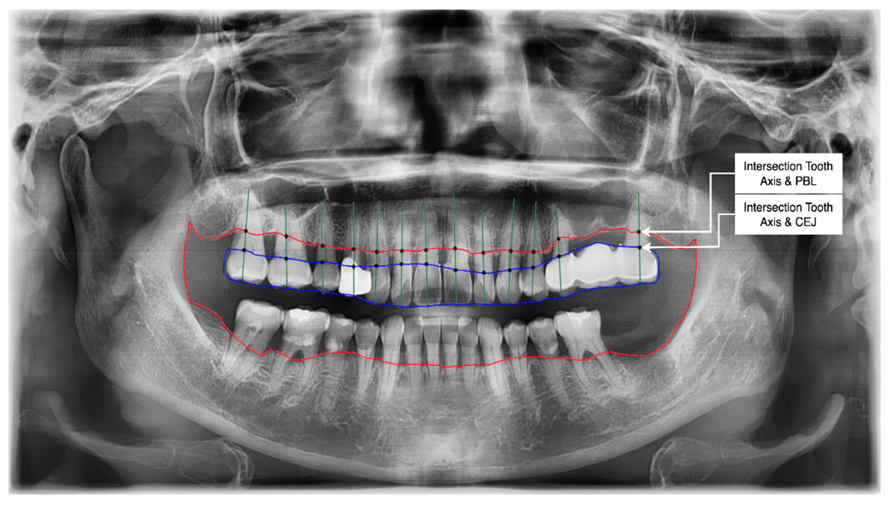 Applsci 12 08500 g010