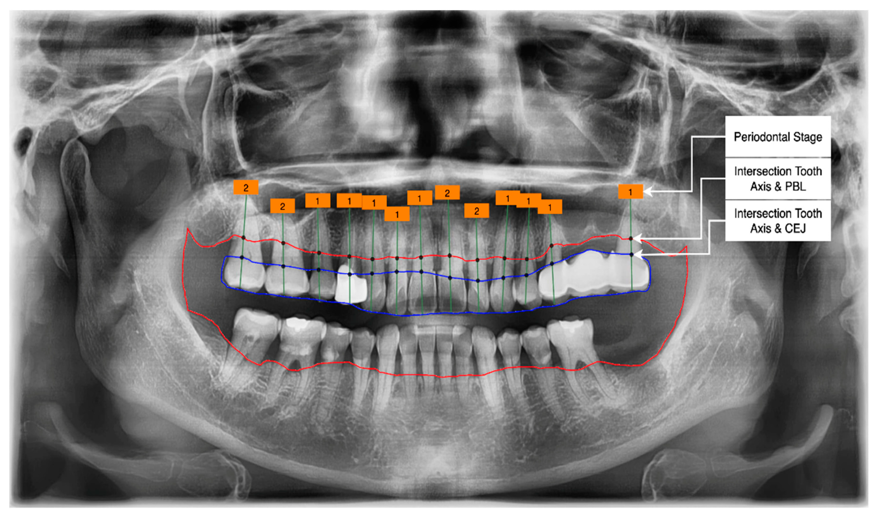 Applsci 12 08500 g011