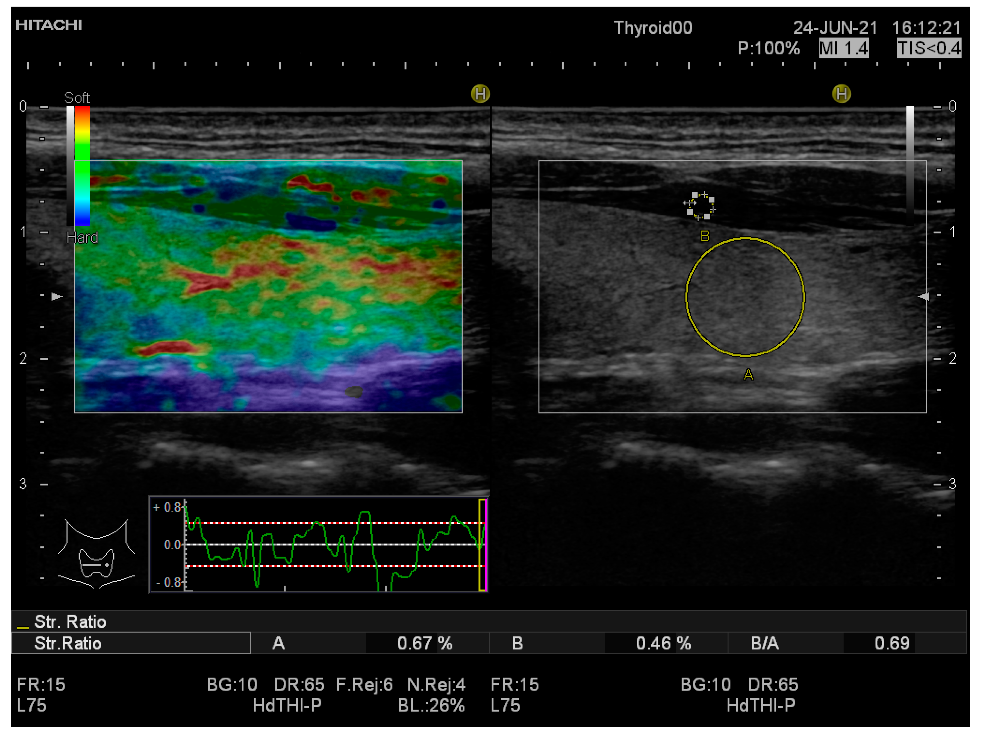 Applsci 12 08881 g002 Applsci 12 08881 g002