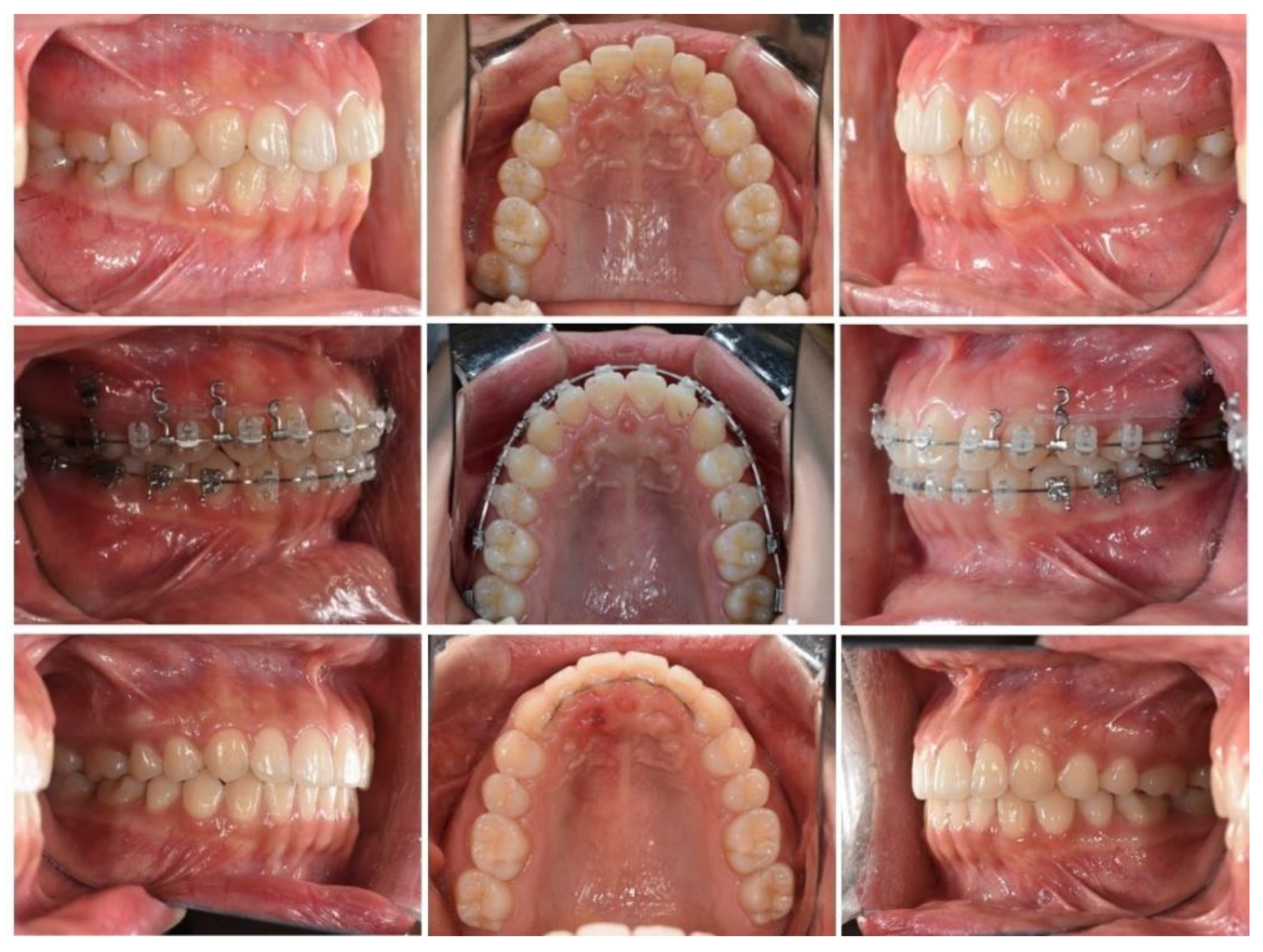 Applsci 12 09040 g002 Applsci 12 09040 g002