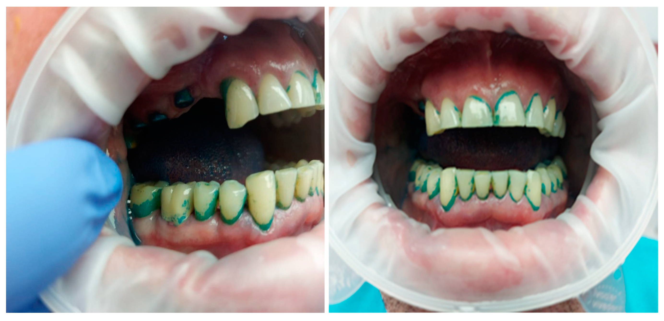 Applsci 12 09067 g002 550