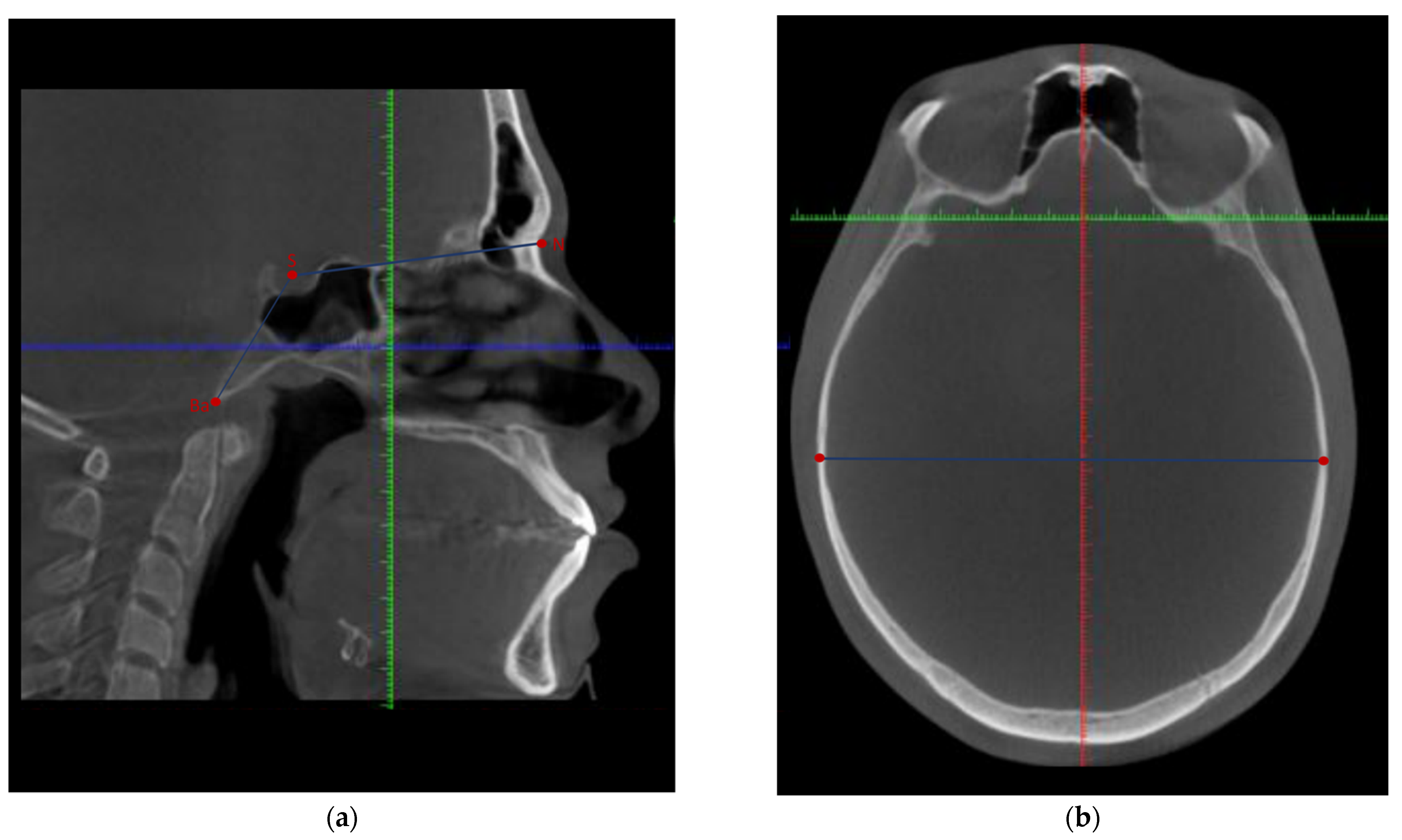 Applsci 12 09199 g001