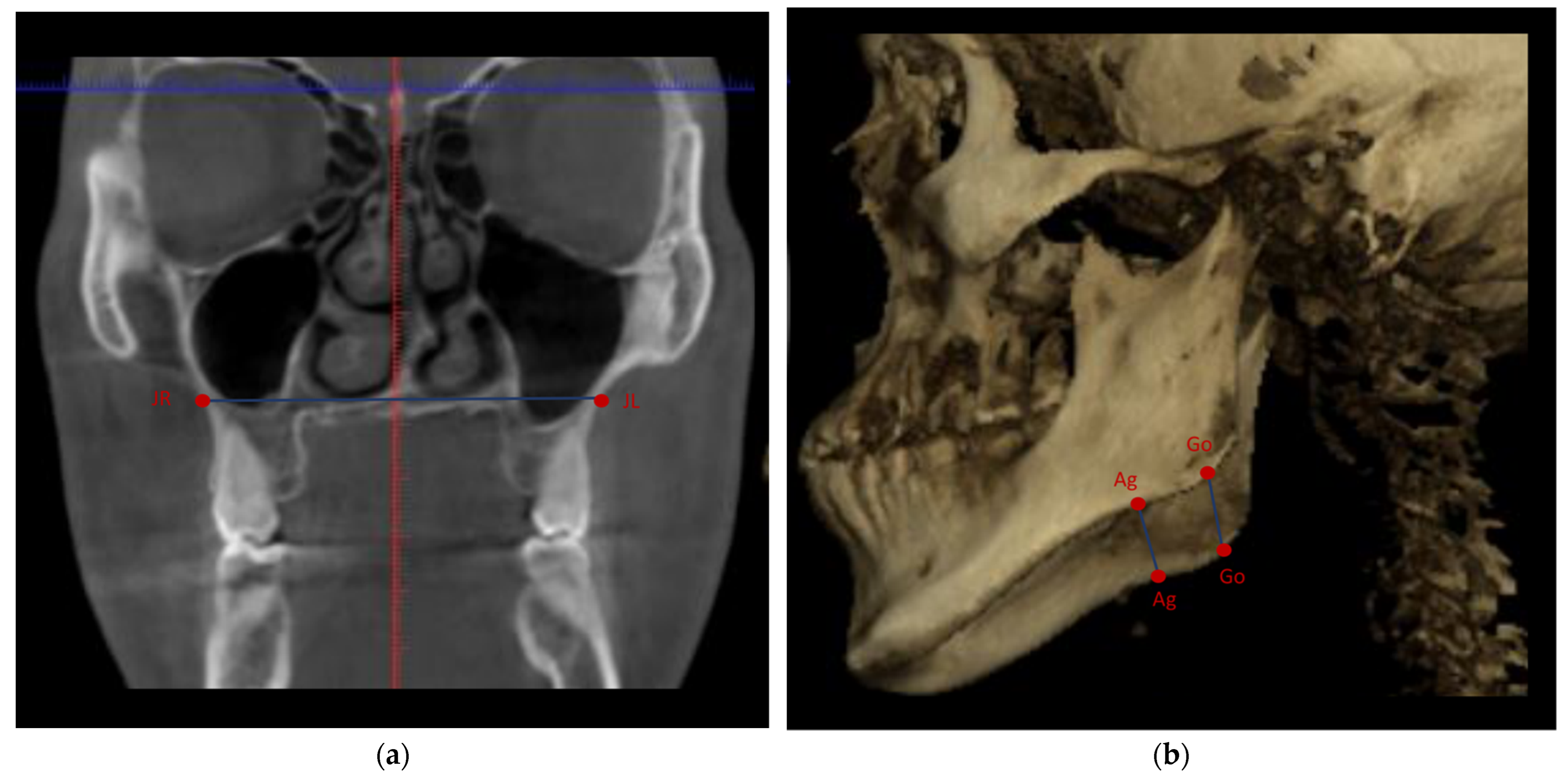 Applsci 12 09199 g002