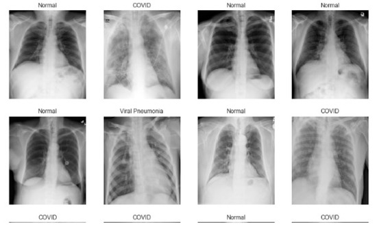 A Novel Approach to Detect COVID-19: Enhanced Deep Learning Models with ...