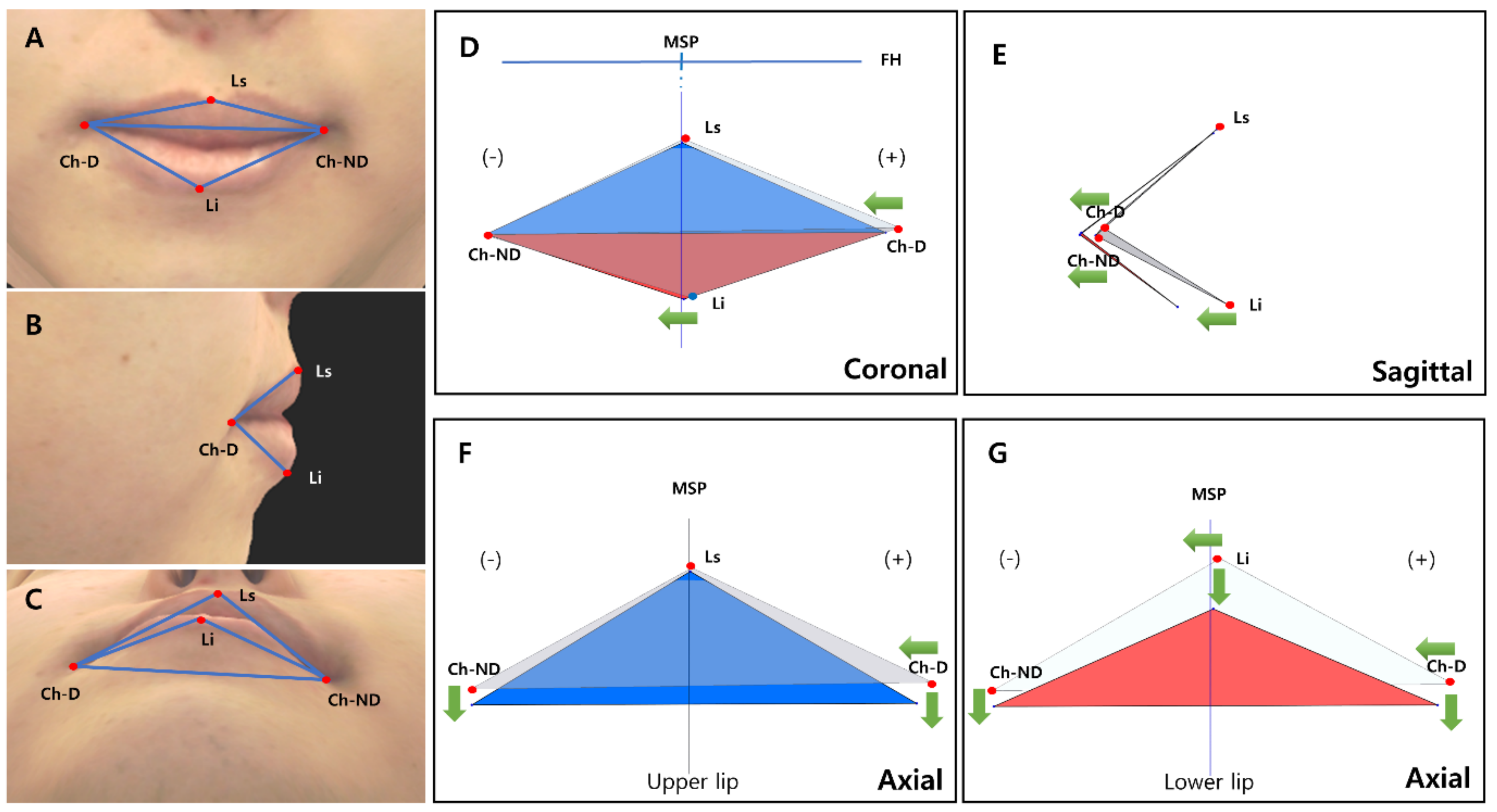 Applsci 12 09385 g004