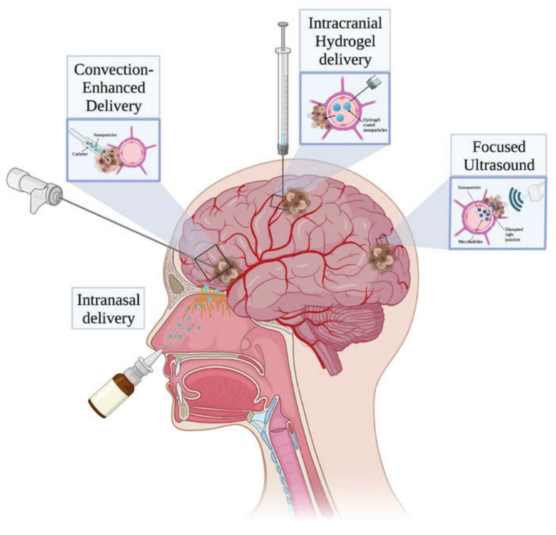 Polymeric Nanoparticles—Tools in a Drug Delivery System in