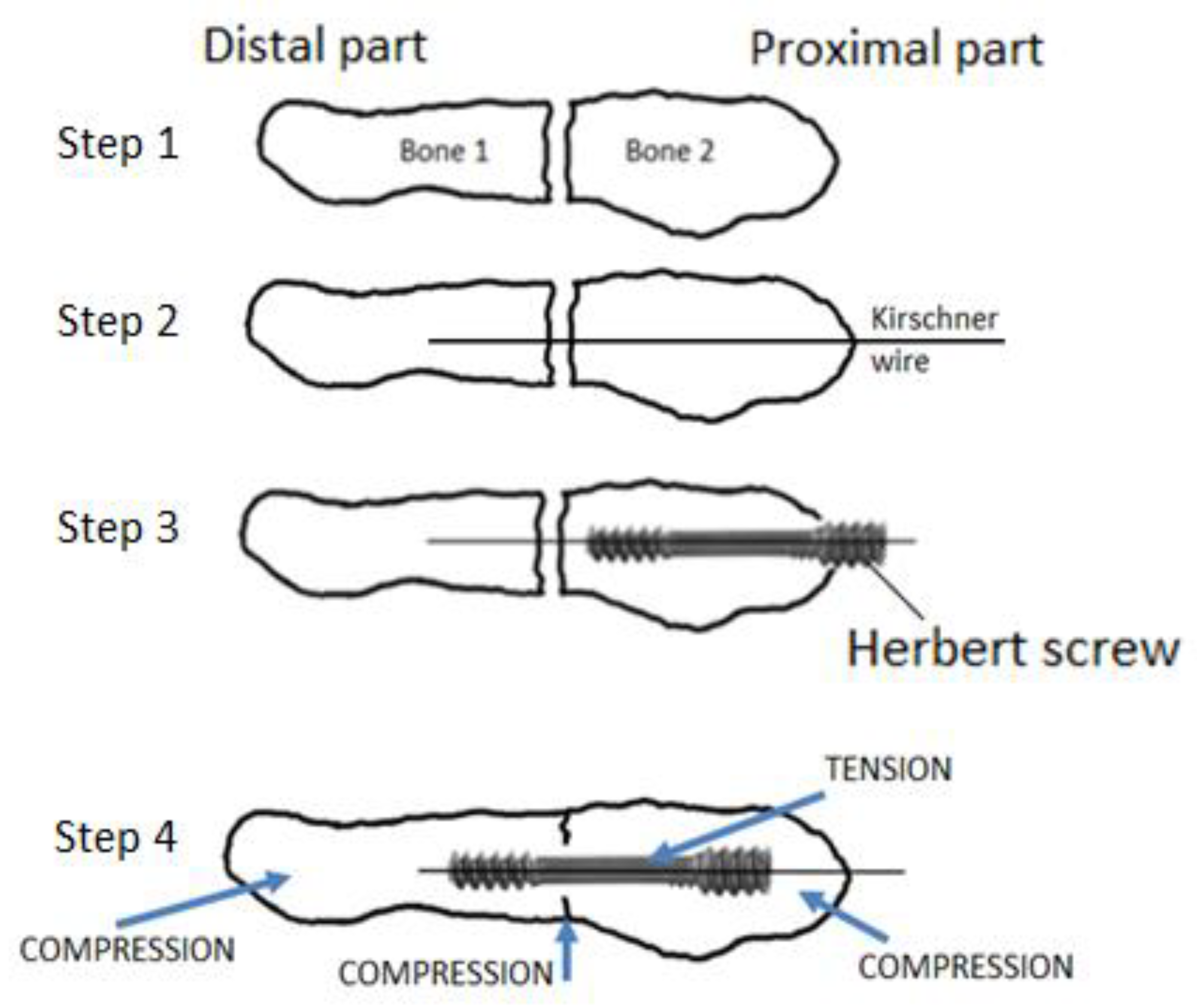 Applsci 12 09615 g004