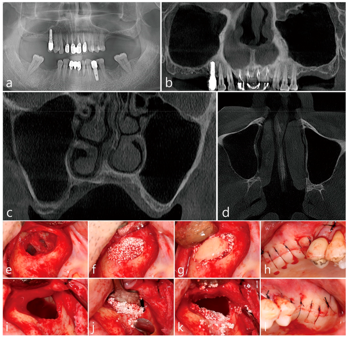 Applied Sciences Free FullText Preliminary Approach for Open
