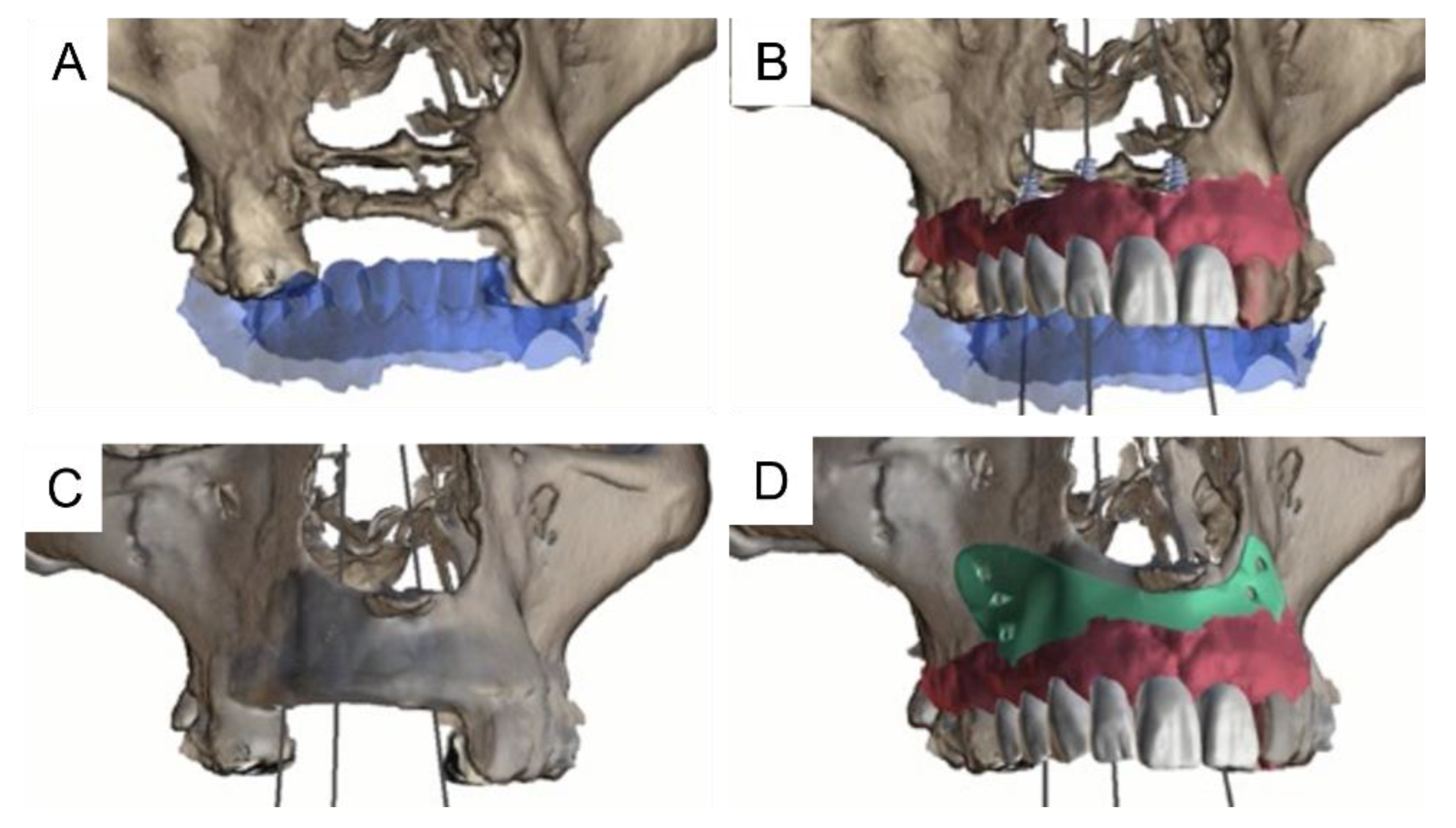 Applsci 12 09947 g005 Applsci 12 09947 g005