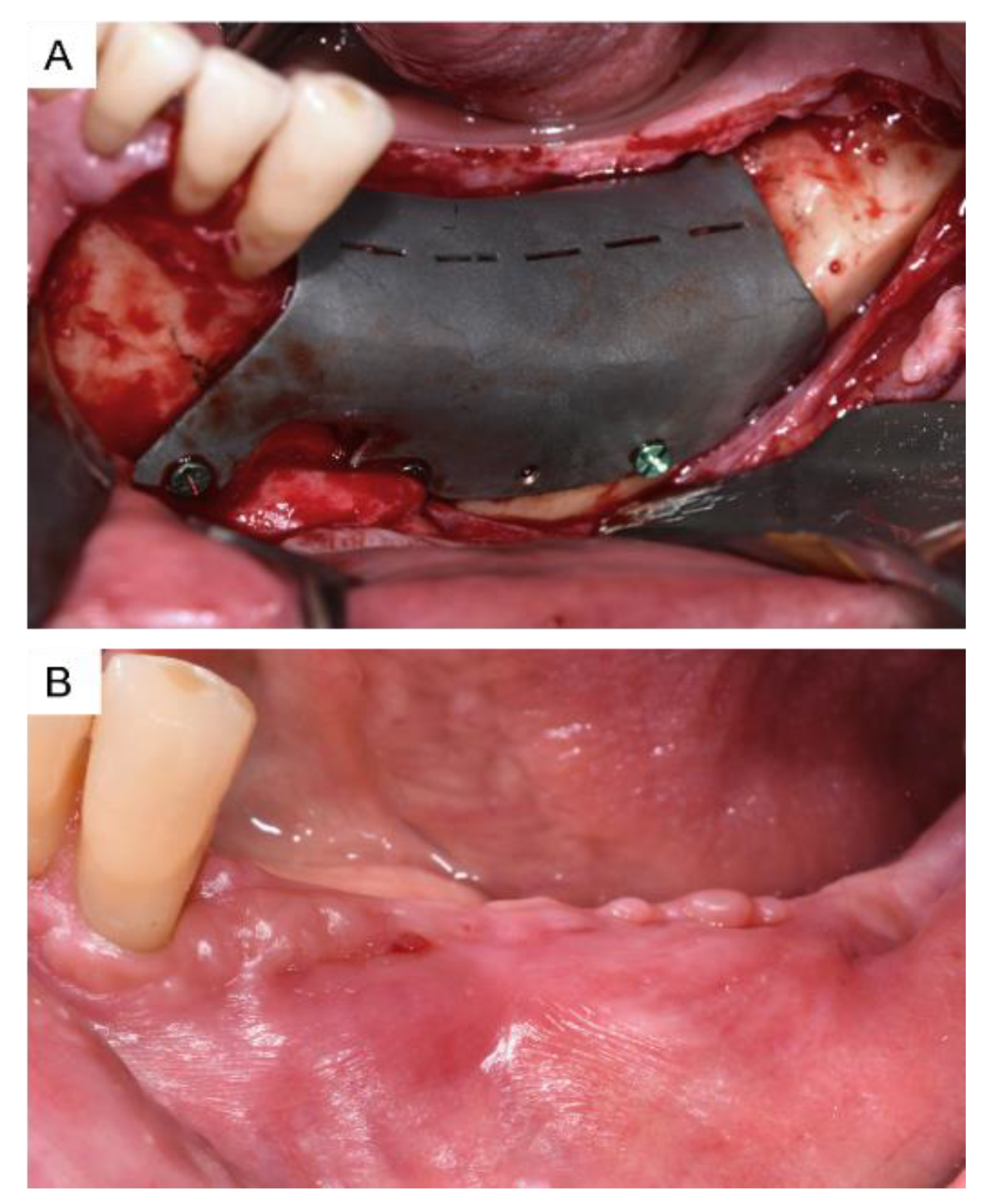 Applsci 12 09947 g006 Applsci 12 09947 g006