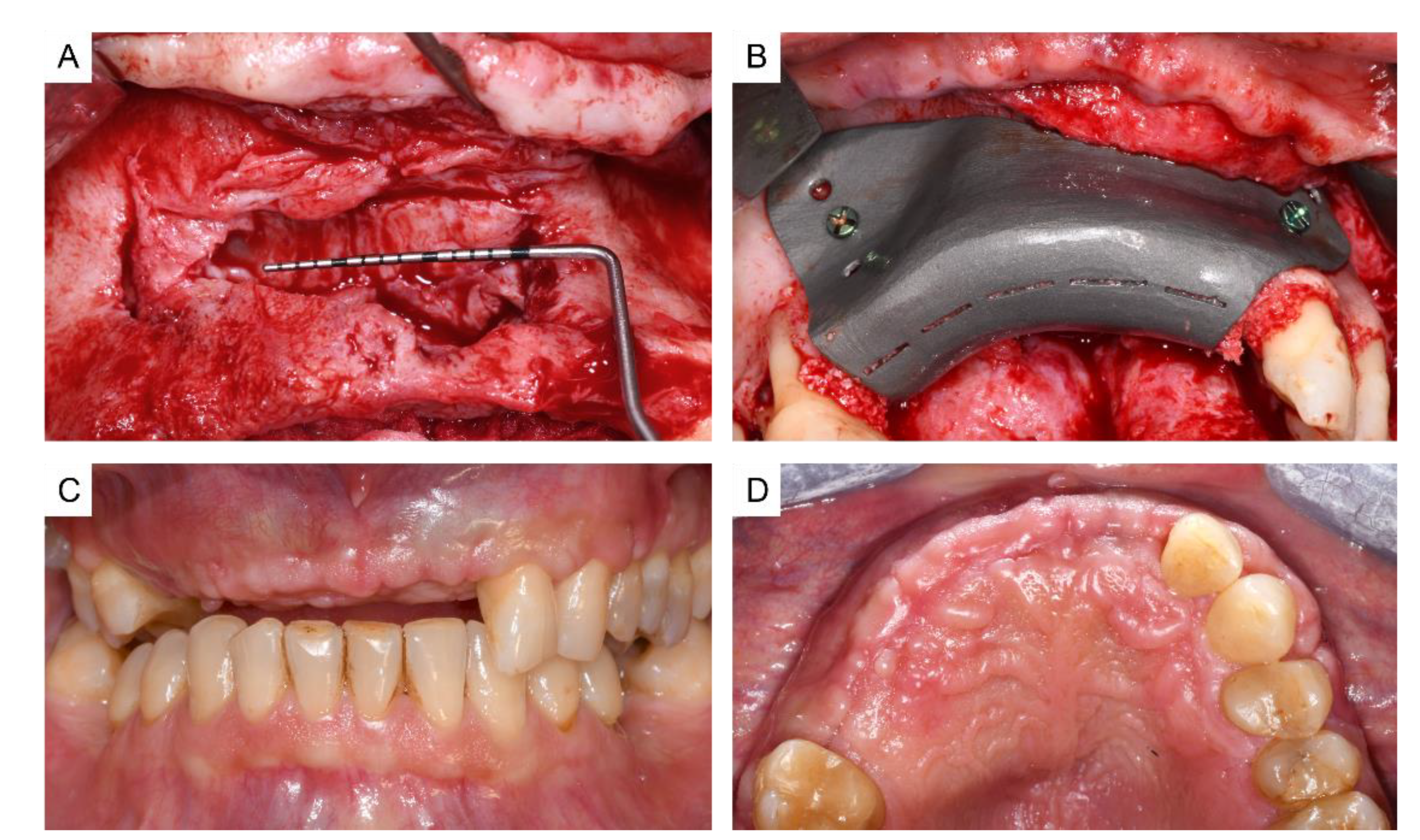 Applsci 12 09947 g007 Applsci 12 09947 g007