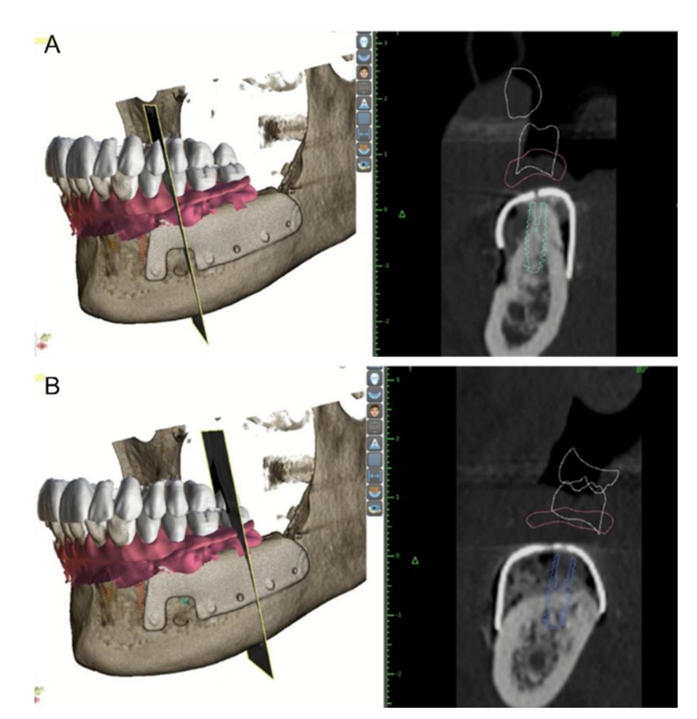 Applsci 12 09947 g008 Applsci 12 09947 g008