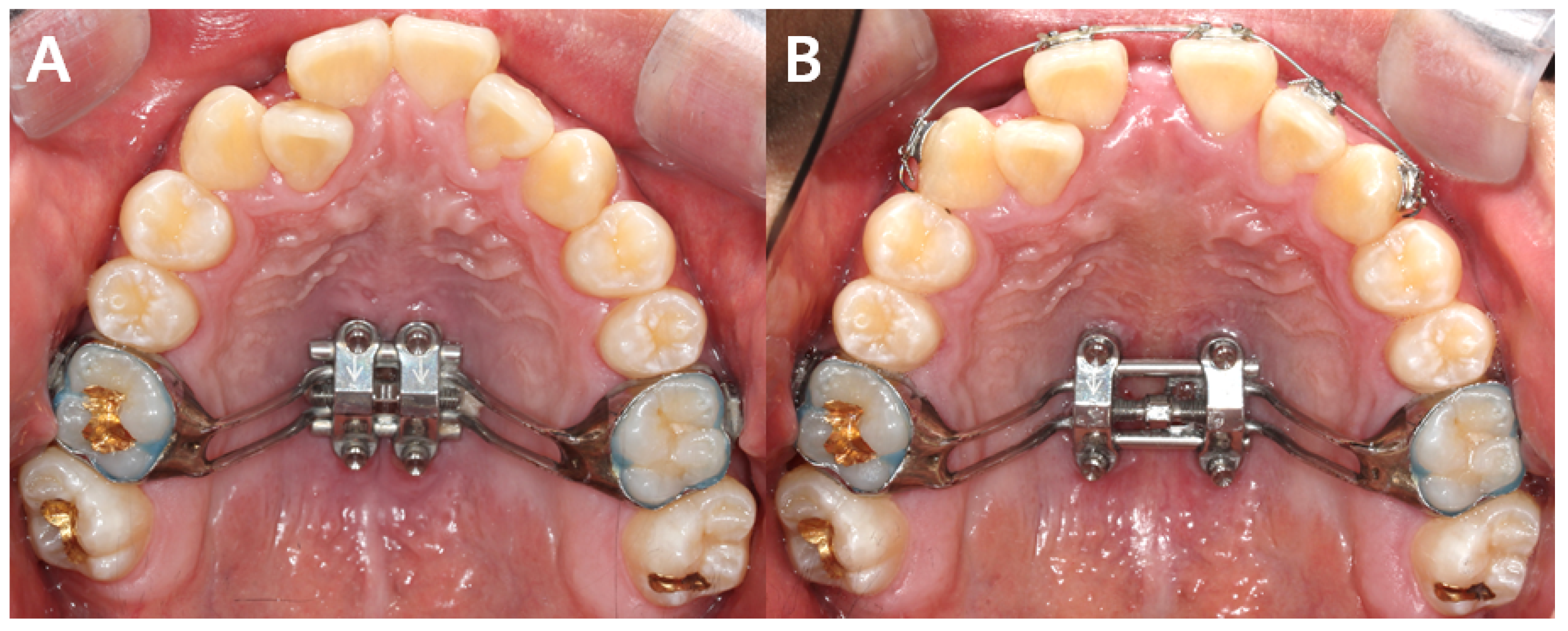 Applied Sciences Free FullText A CBCT Evaluation of Nasal Septal