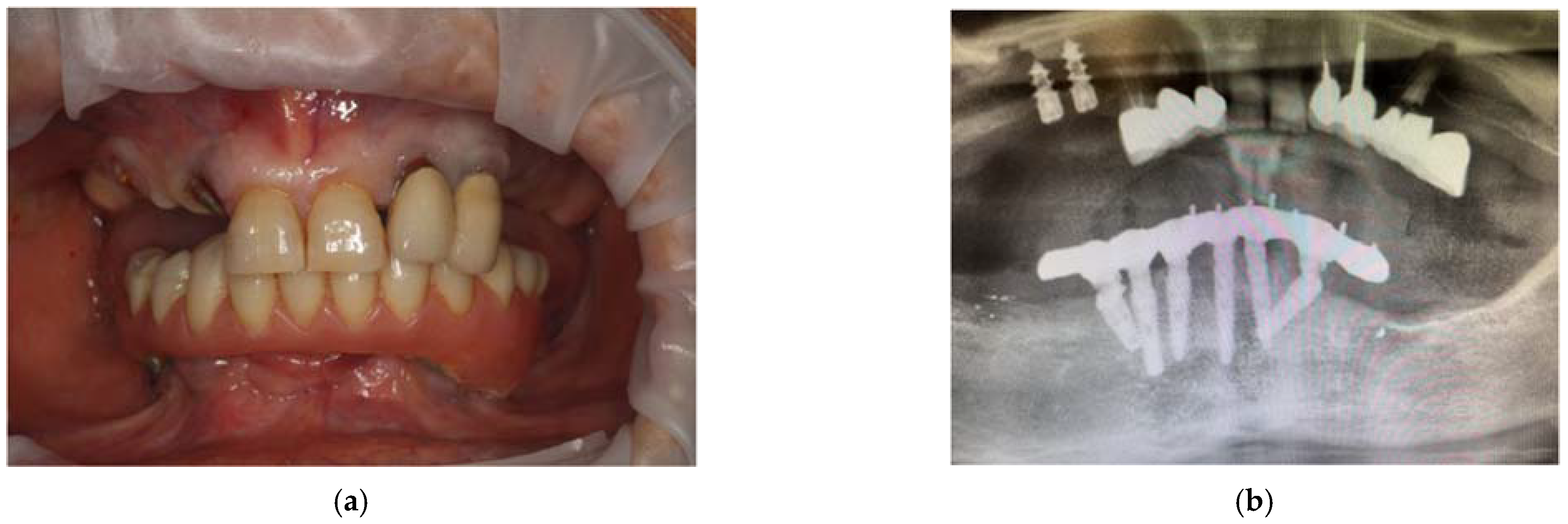 Applsci 12 09995 g004a