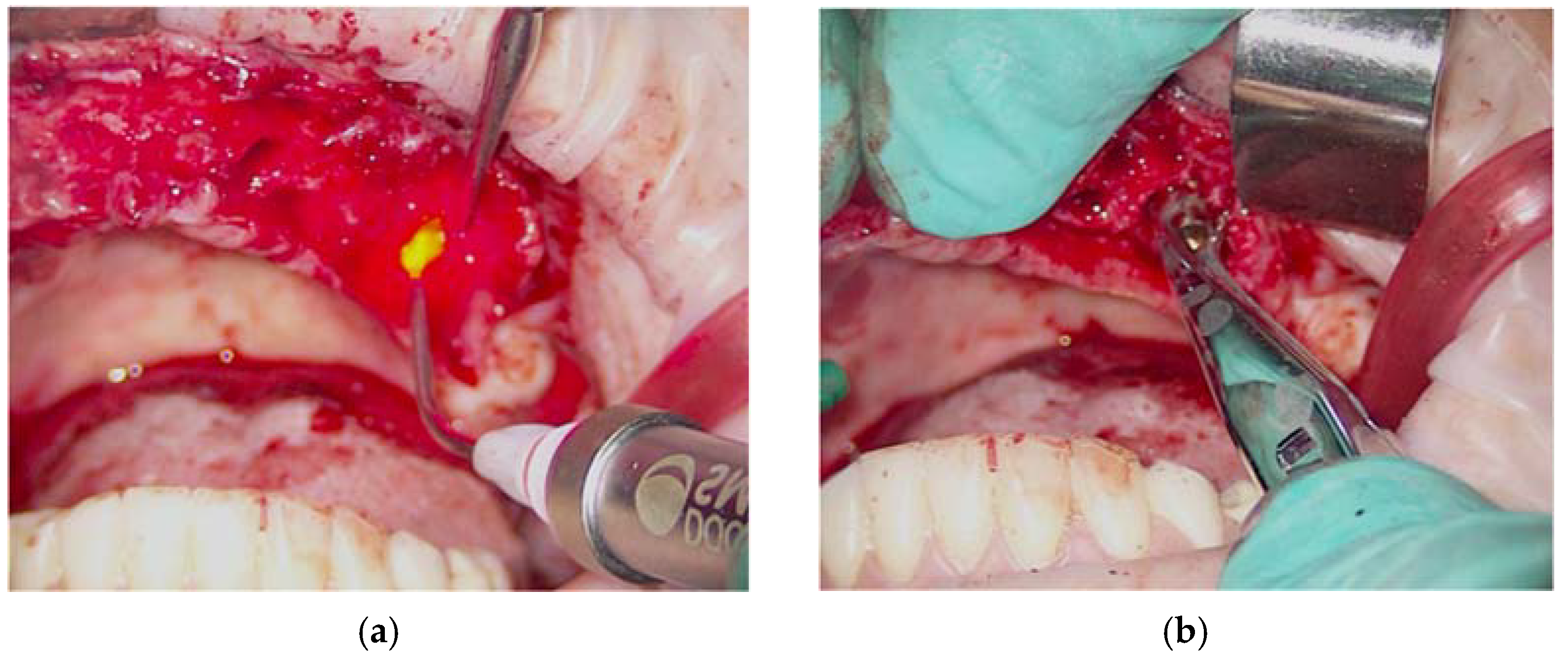 Applsci 12 09995 g005