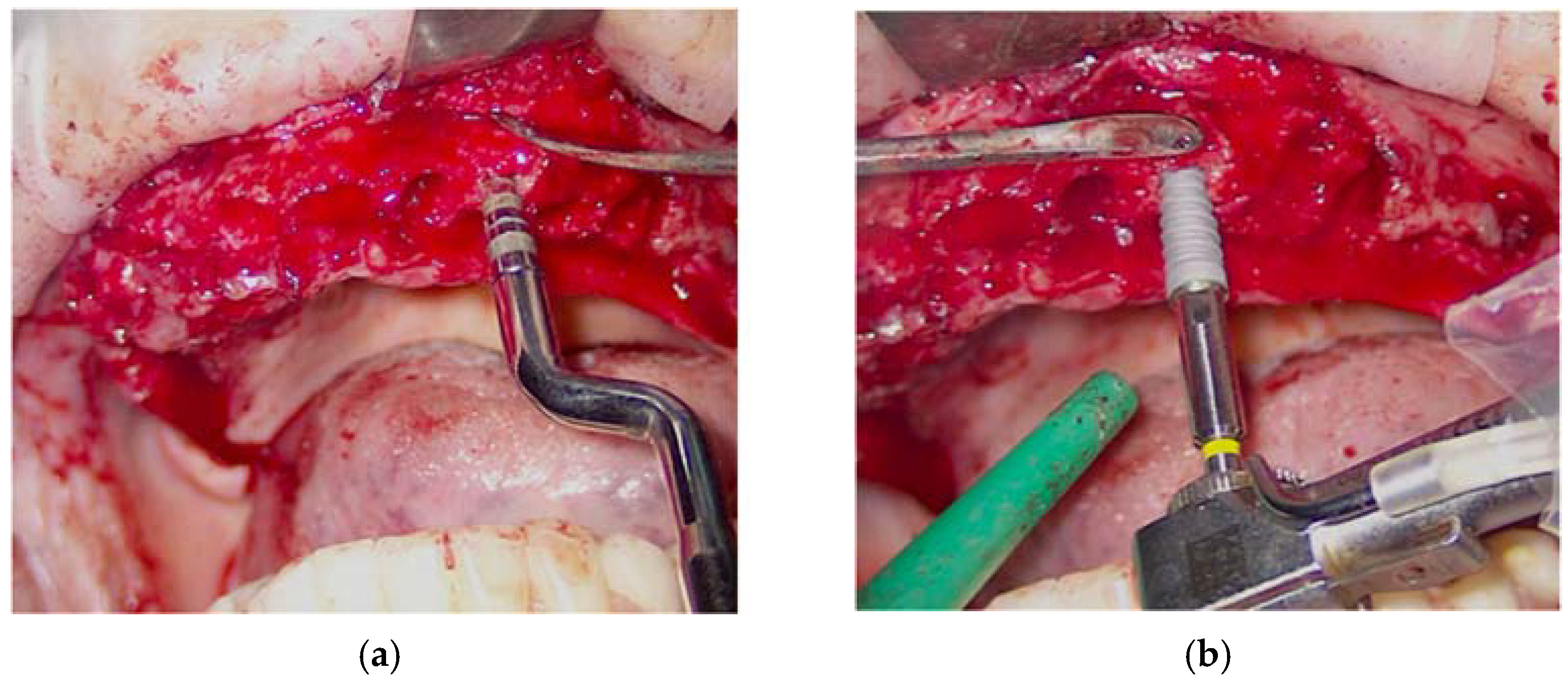 Applsci 12 09995 g006