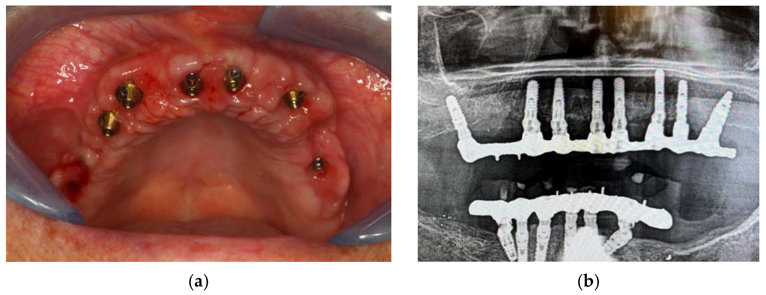 Applsci 12 09995 g008