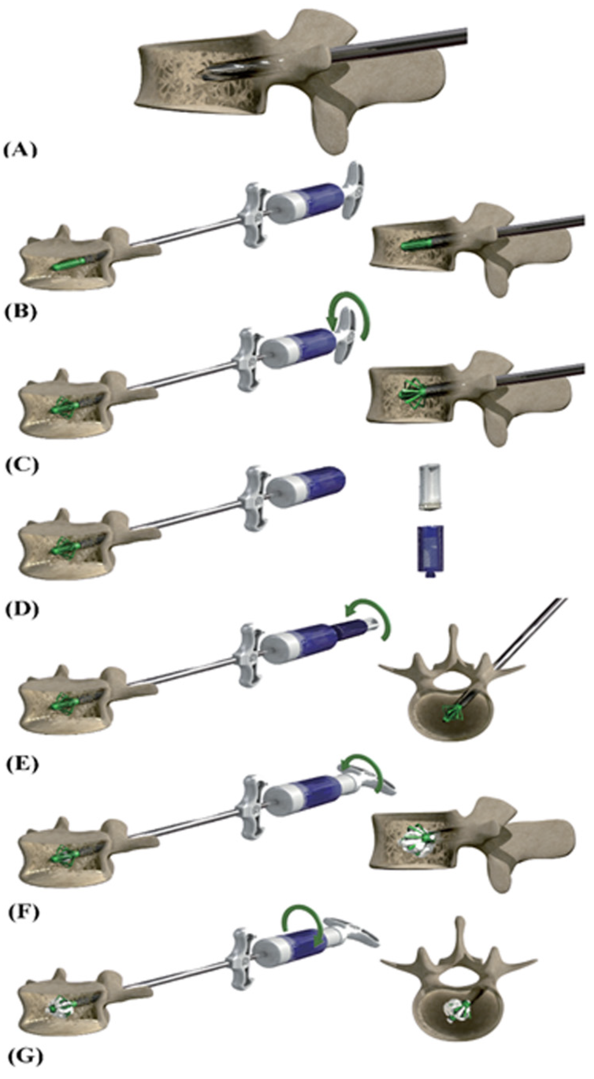 Applsci 12 10165 g003