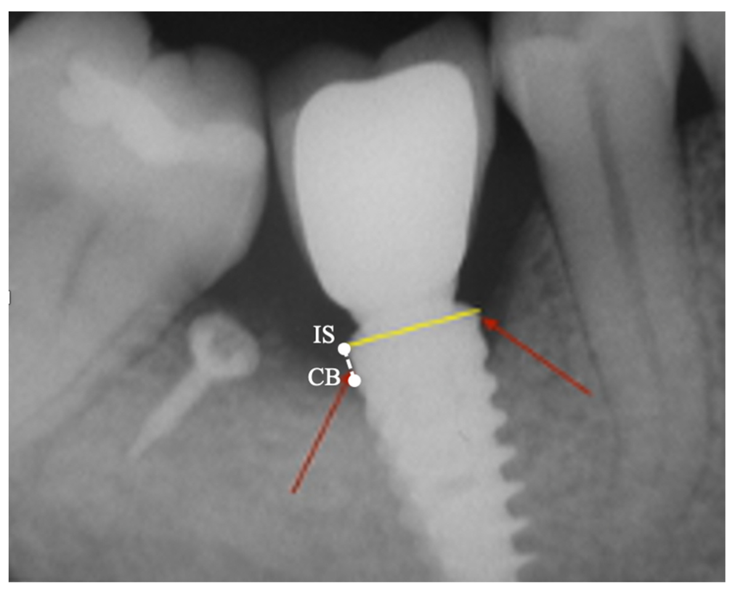 Applsci 12 10285 g005 Applsci 12 10285 g005