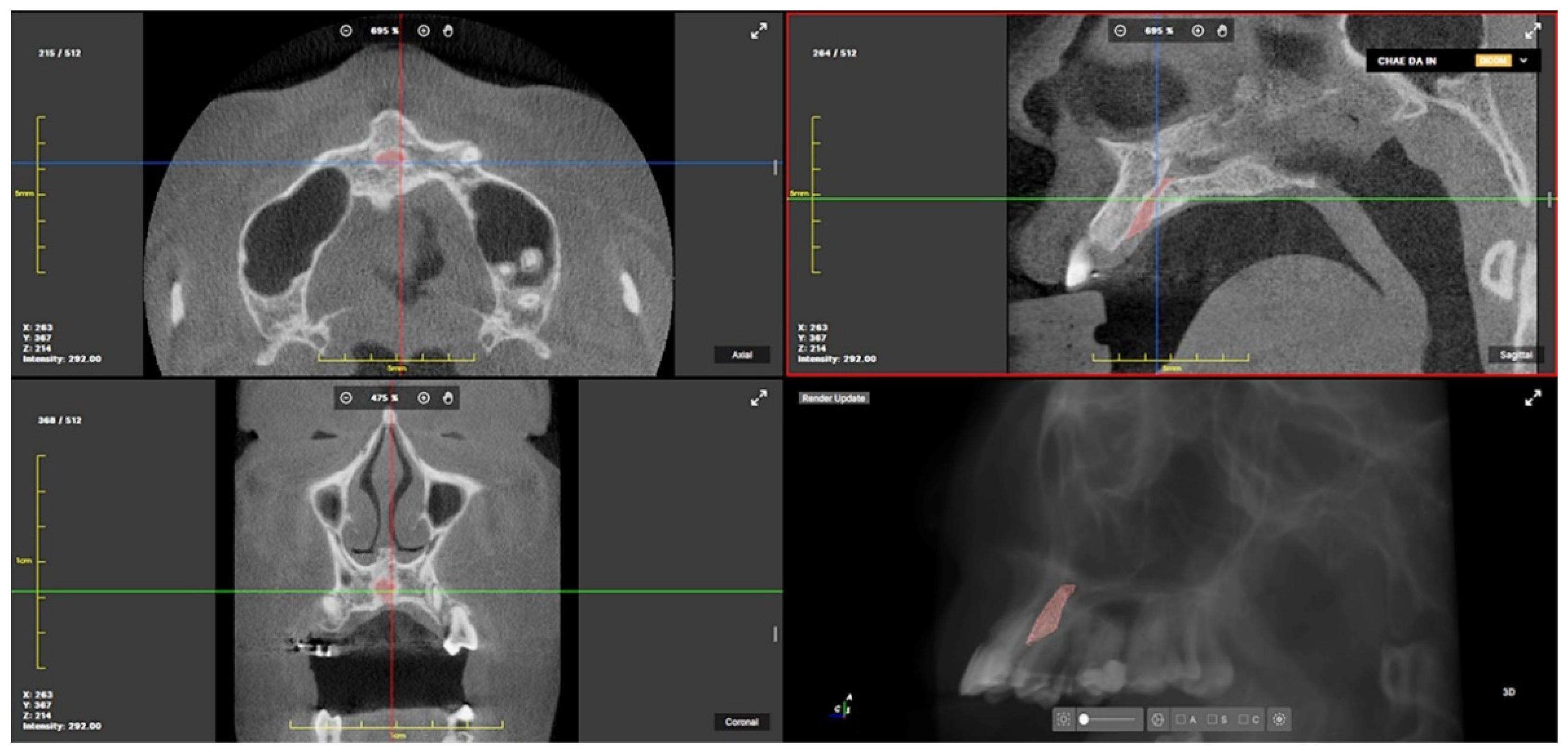 Applsci 12 10470 g004