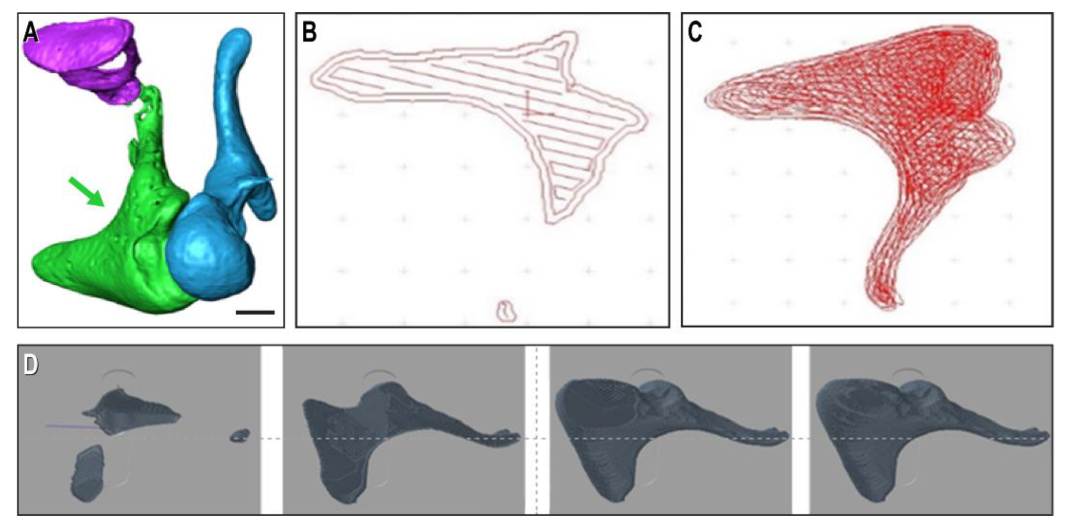 Artwork Of Prosthetic Stapes In Middle Ear Photograph by John