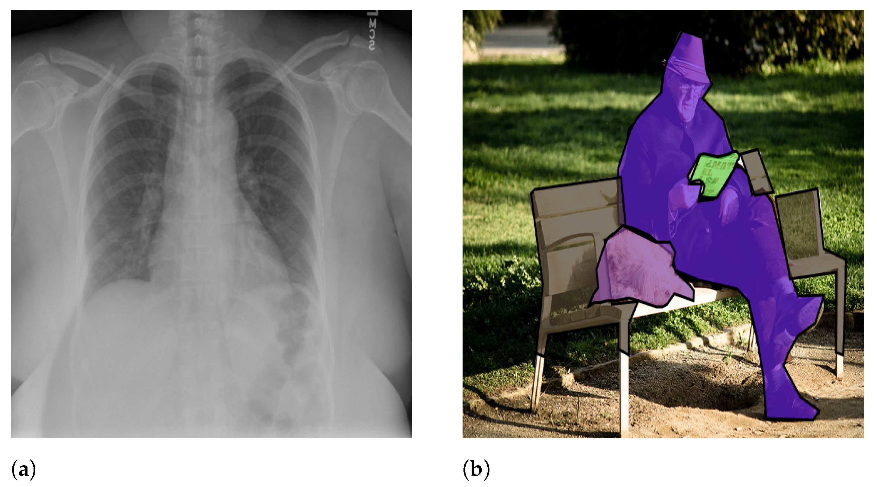 Applsci 12 11092 g001