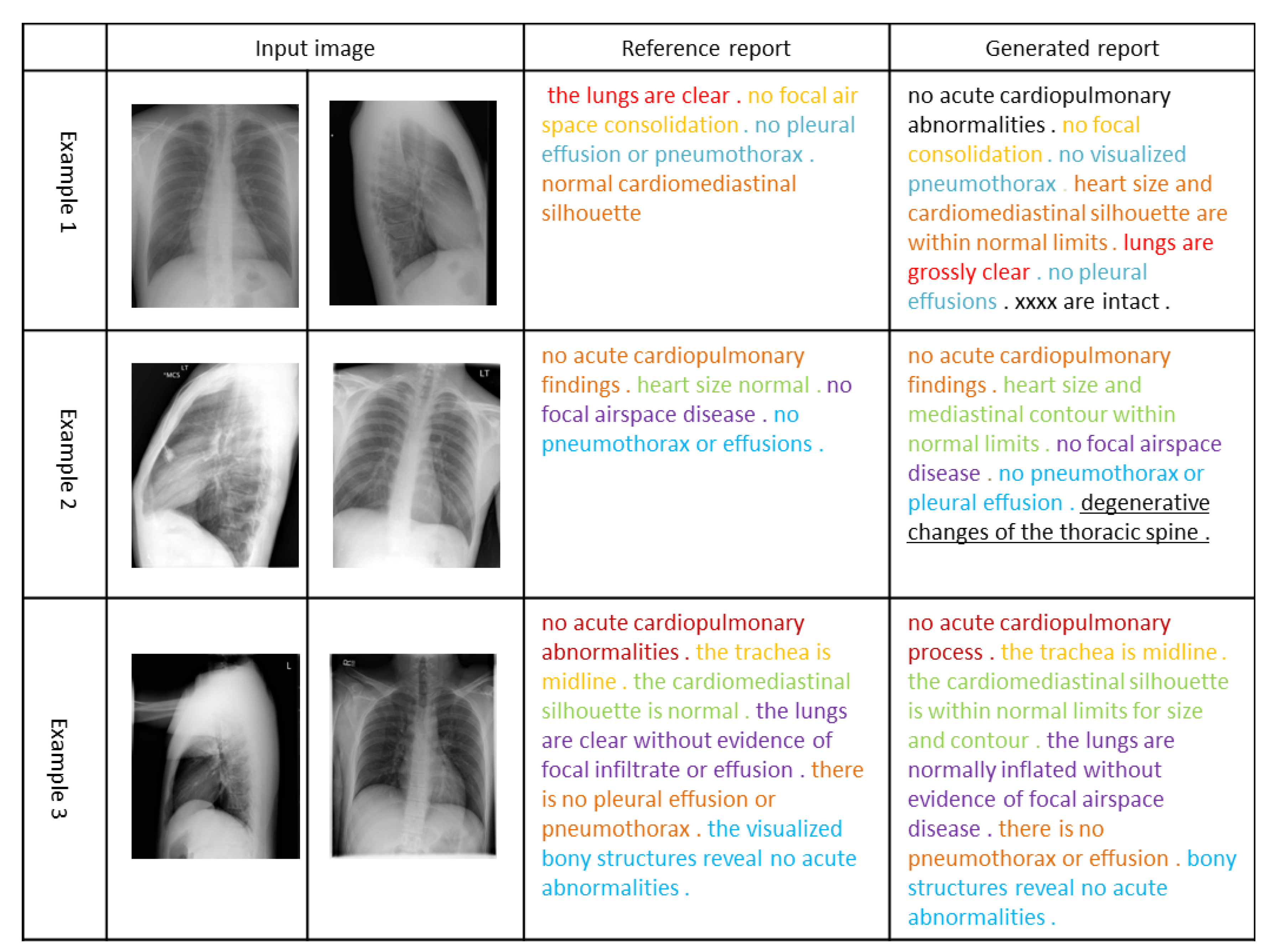 Applied Sciences Free FullText Improving Medical Xray Report