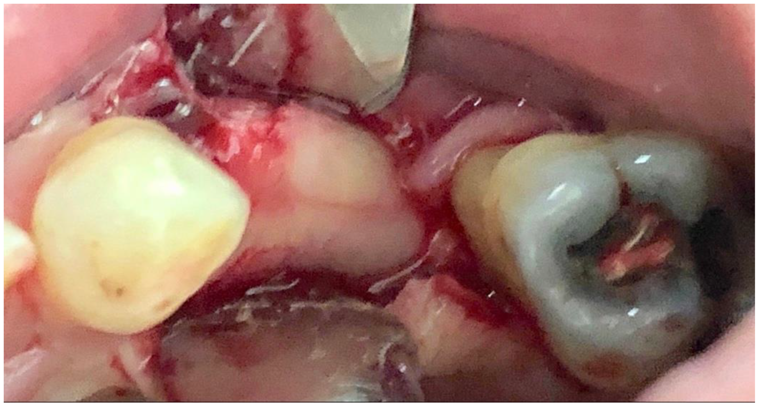 Applsci 12 11247 g003 Applsci 12 11247 g003