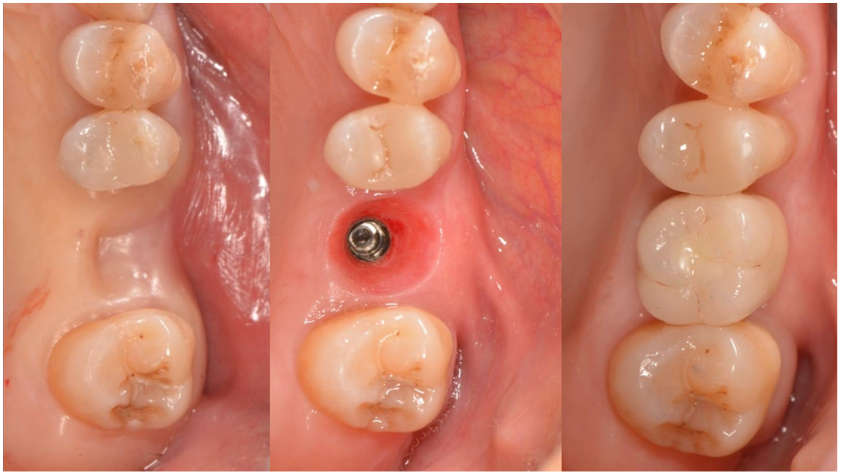 Applsci 12 11247 g011 Applsci 12 11247 g011