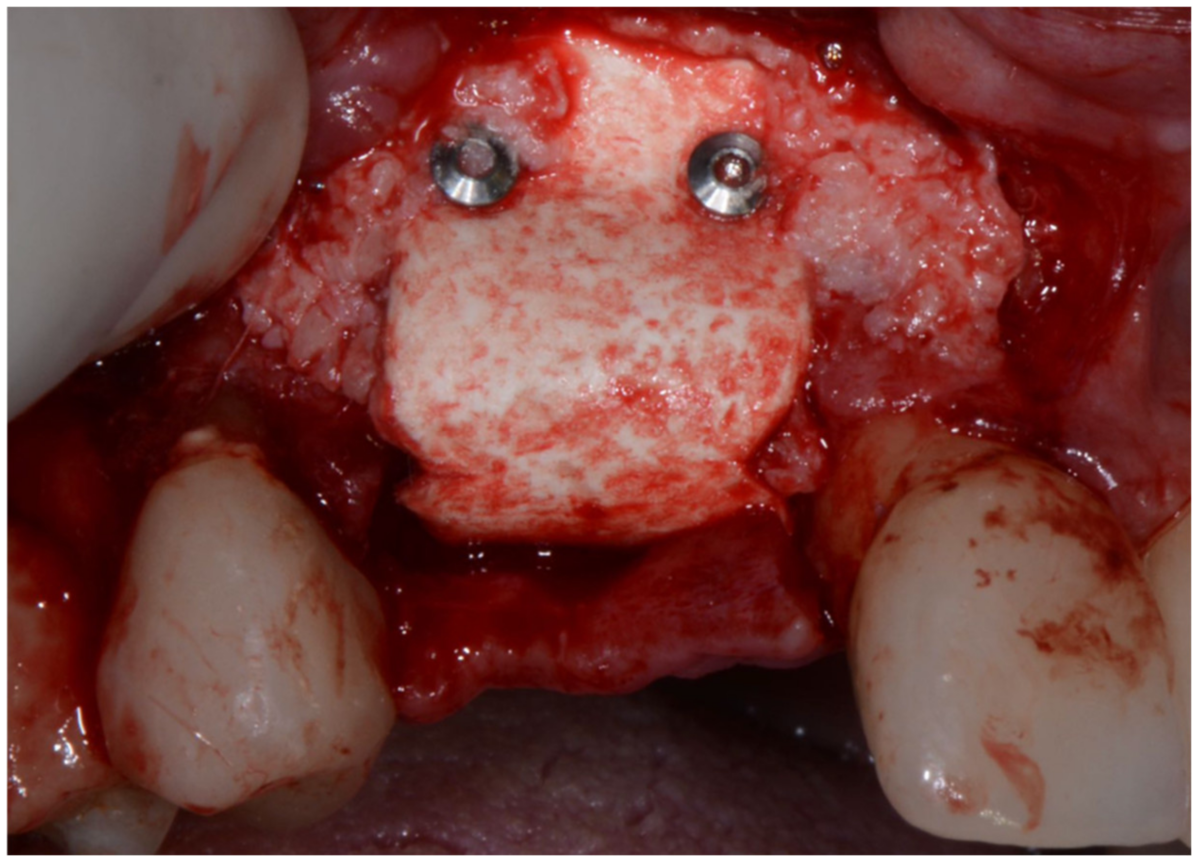 Applsci 12 11247 g015 Applsci 12 11247 g015