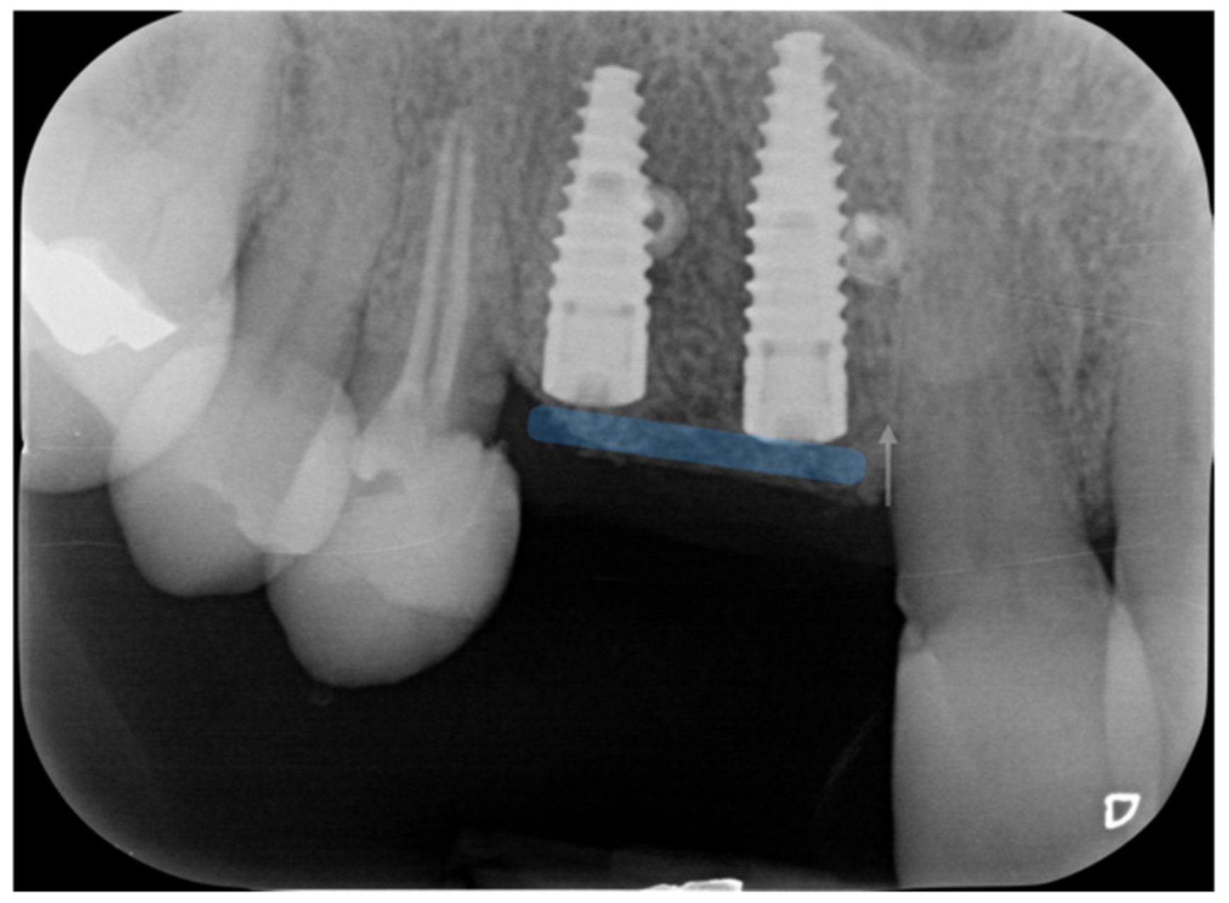 Applsci 12 11247 g020 Applsci 12 11247 g020