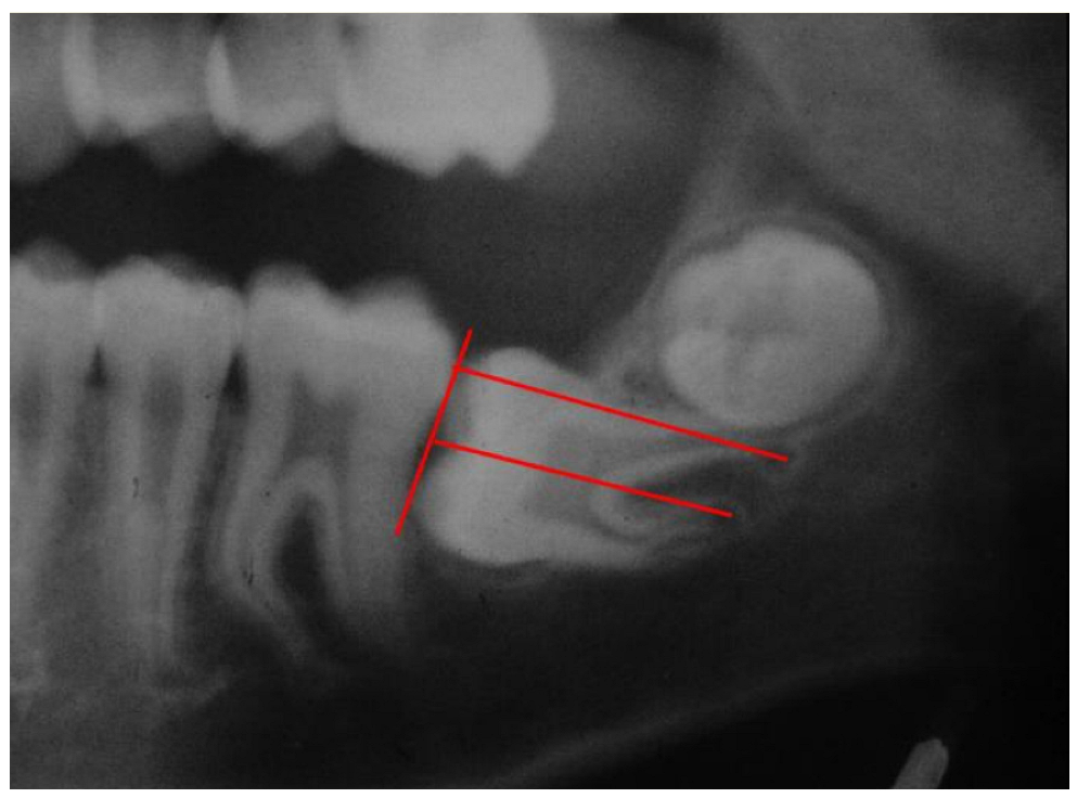 Applsci 12 11520 g005 Applsci 12 11520 g005