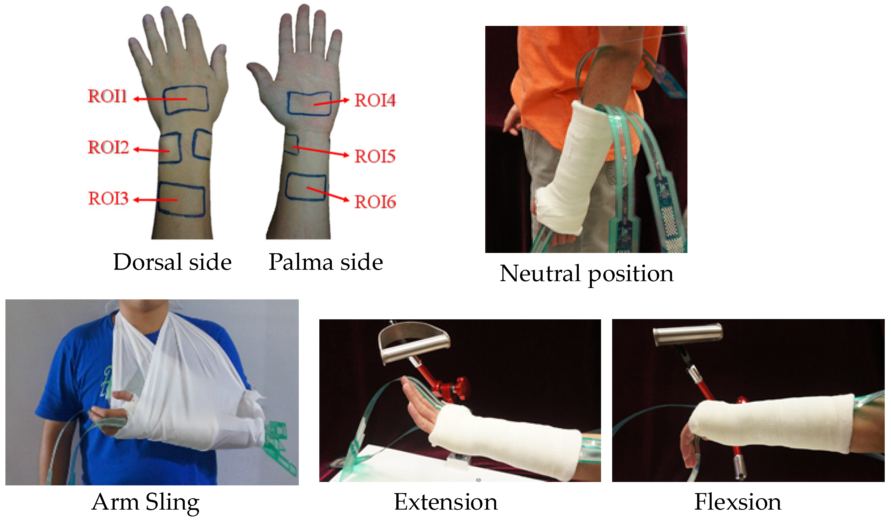 Applied Sciences Free FullText Clinical Assessment of Customized