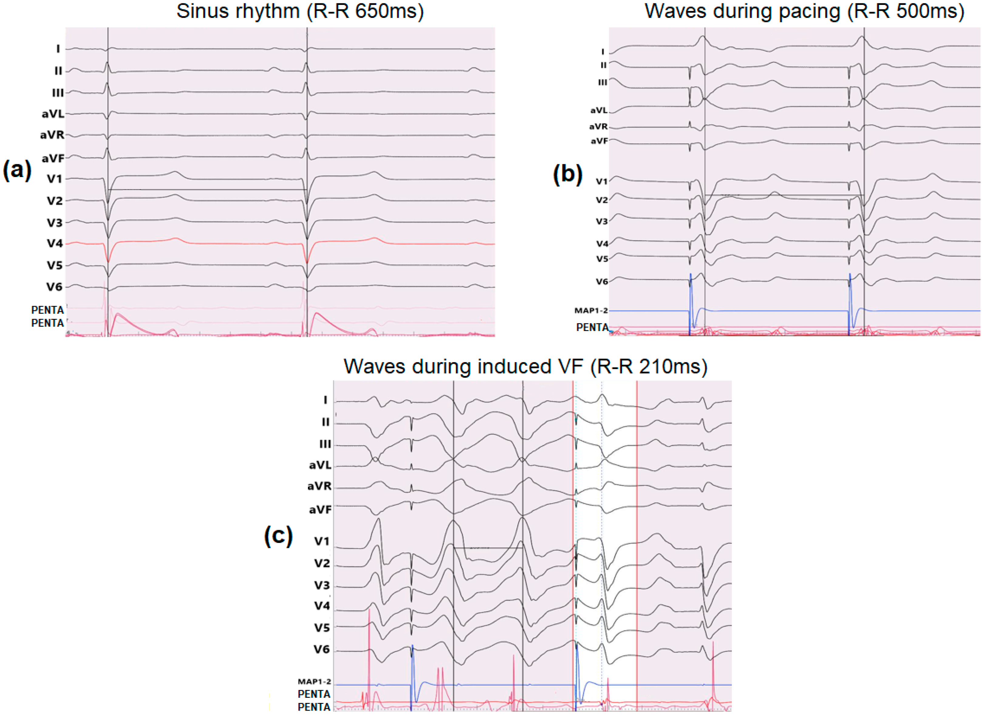 Applsci 12 11620 g009