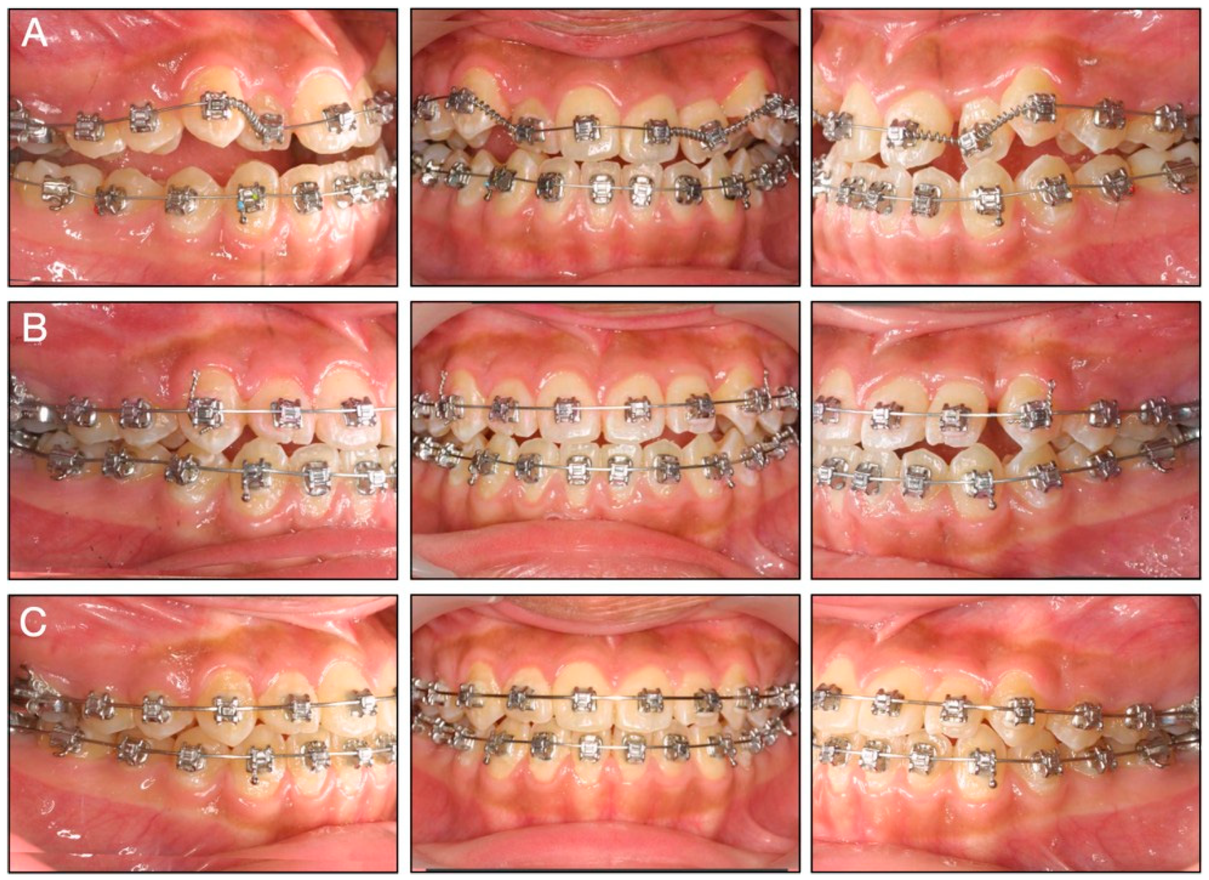 Applsci 12 11719 g003 Applsci 12 11719 g003