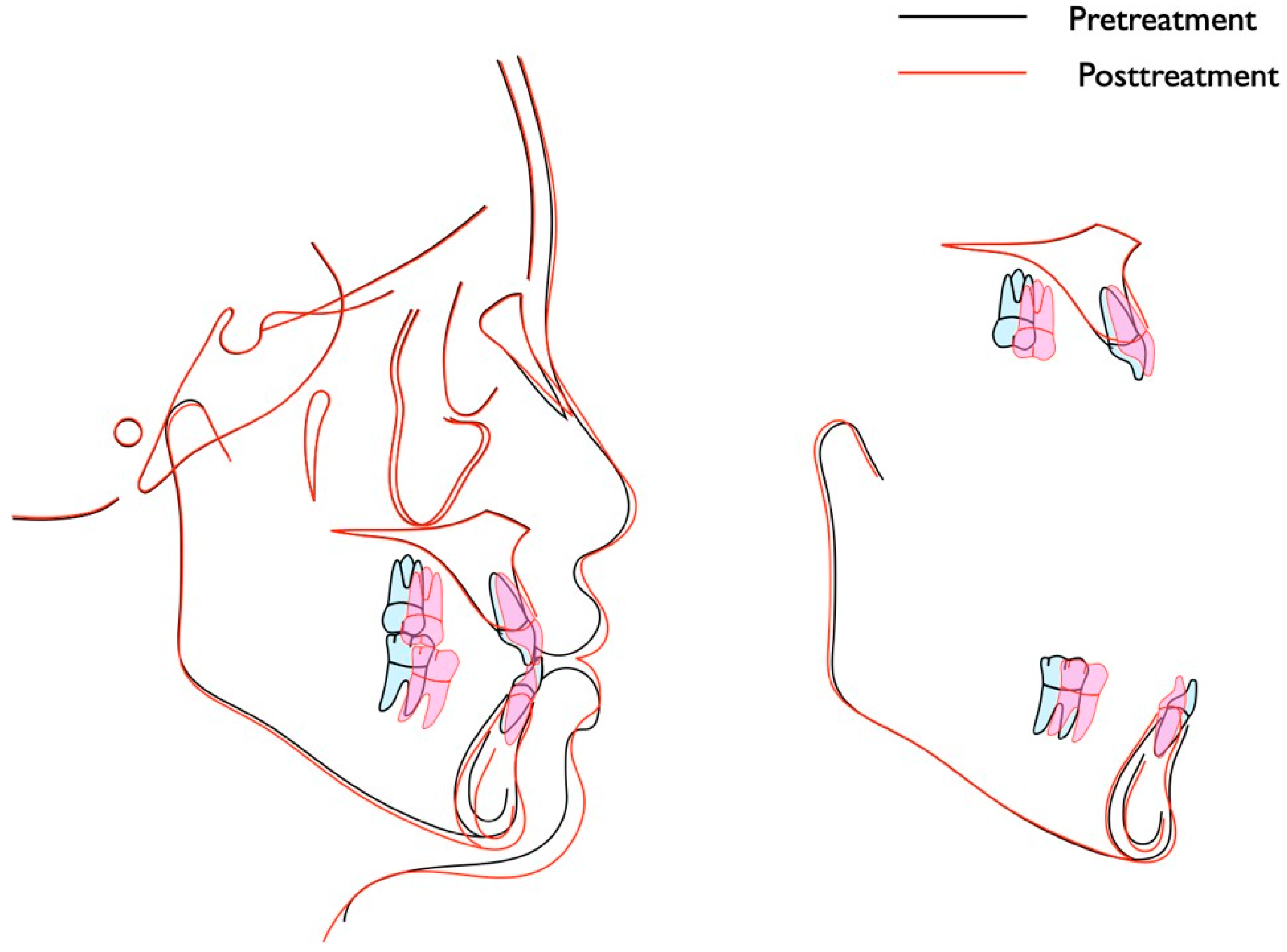 Applsci 12 11719 g007 Applsci 12 11719 g007