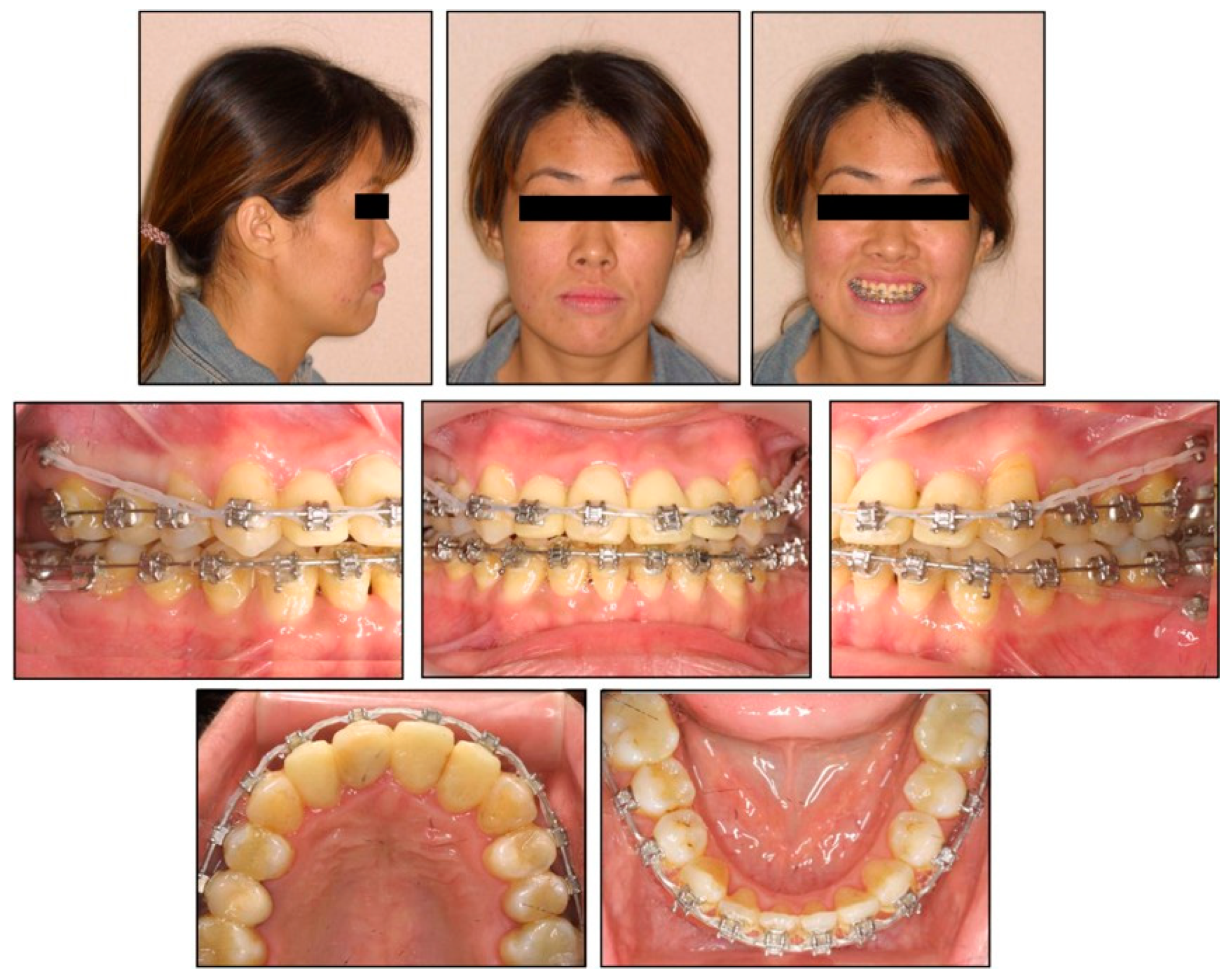 Applsci 12 11719 g012 Applsci 12 11719 g012