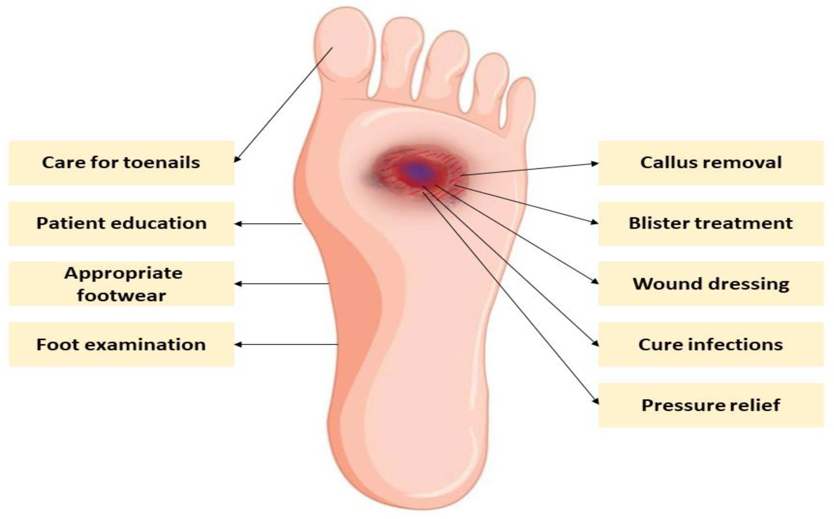 Prevention and Proper Care of Diabetic Foot Ulcers | Healogics