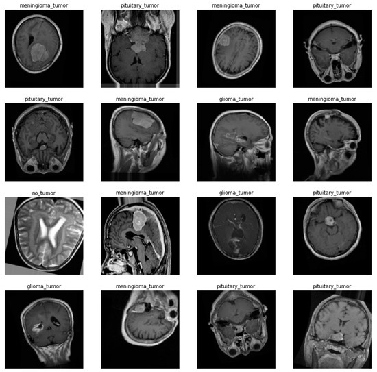 AI Approaches in Computer-Aided Diagnosis and Recognition of