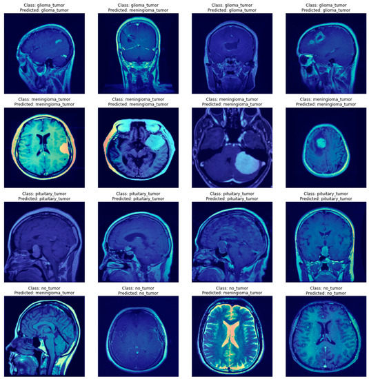 【美品・電子版使用済】Diagnostic Imaging: Brain 脳画像 AI Approaches in Computer-Aided Diagnosis and Recognition of