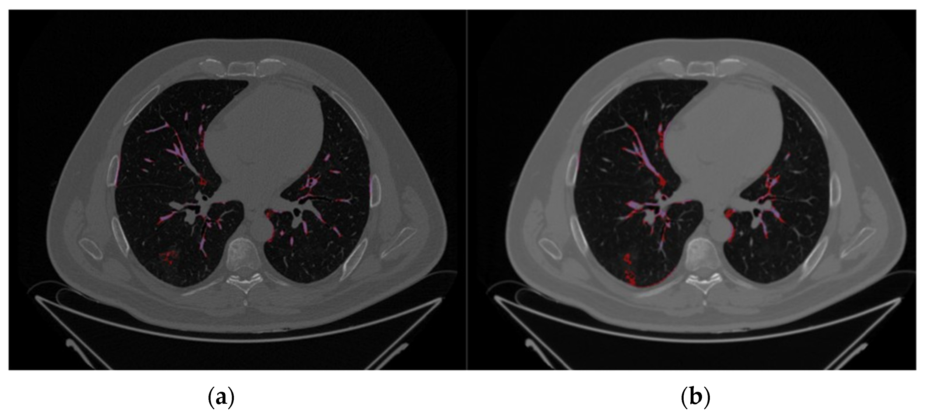 Applsci 12 12065 g002 Applsci 12 12065 g002