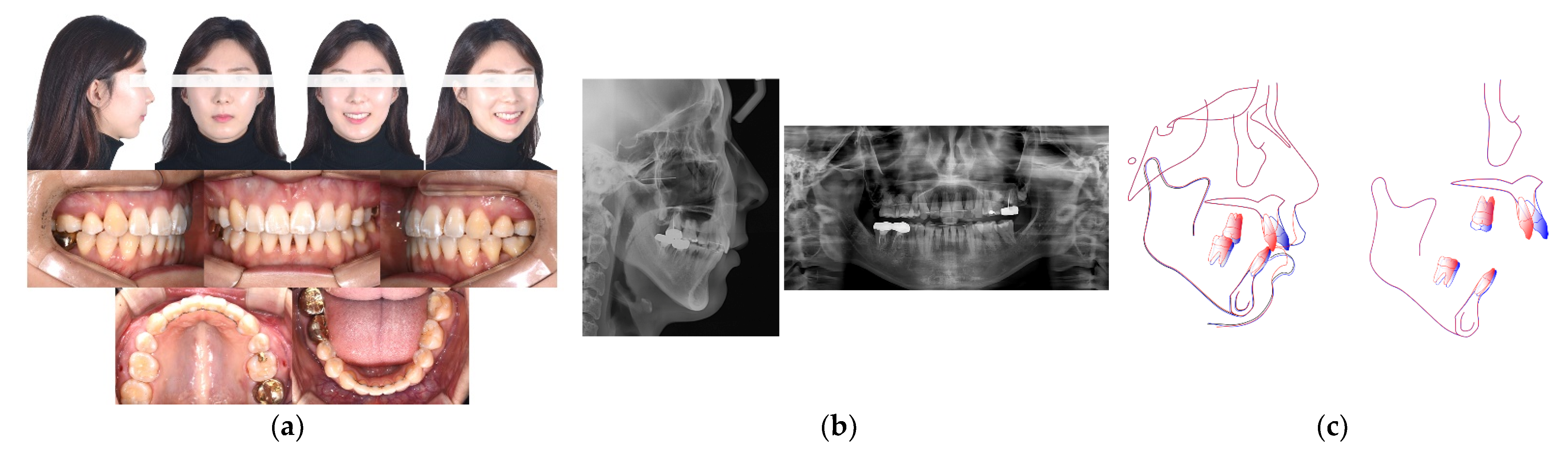 Applsci 12 12098 g005 Applsci 12 12098 g005