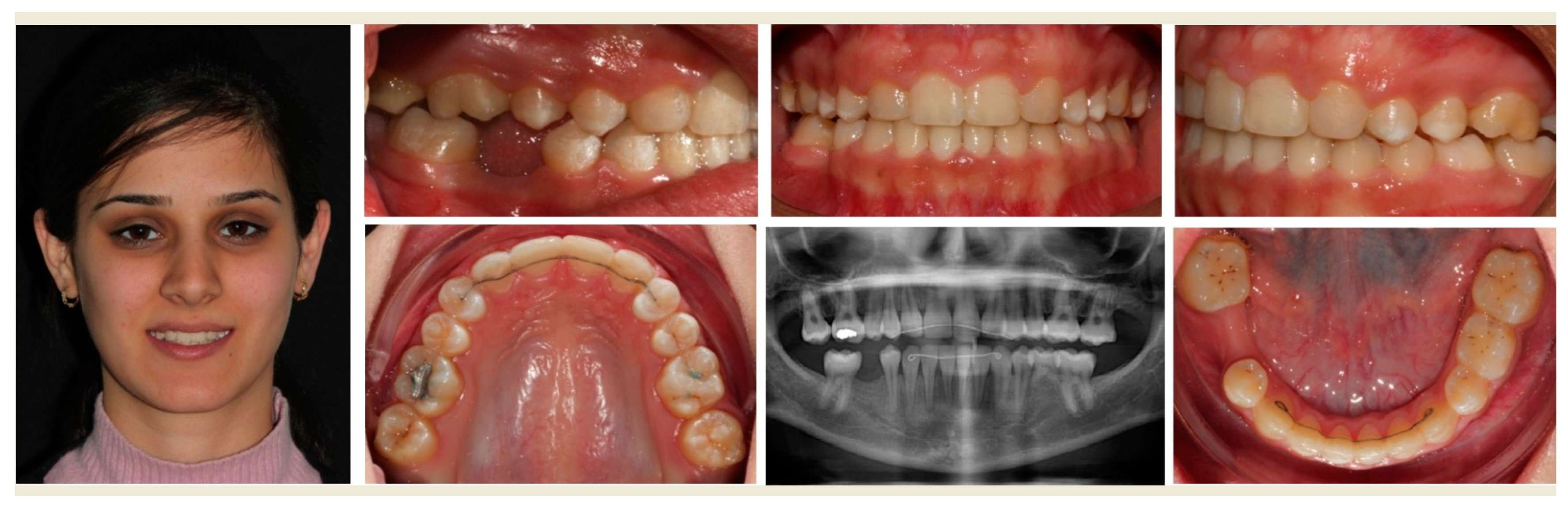 Applsci 12 12252 g002