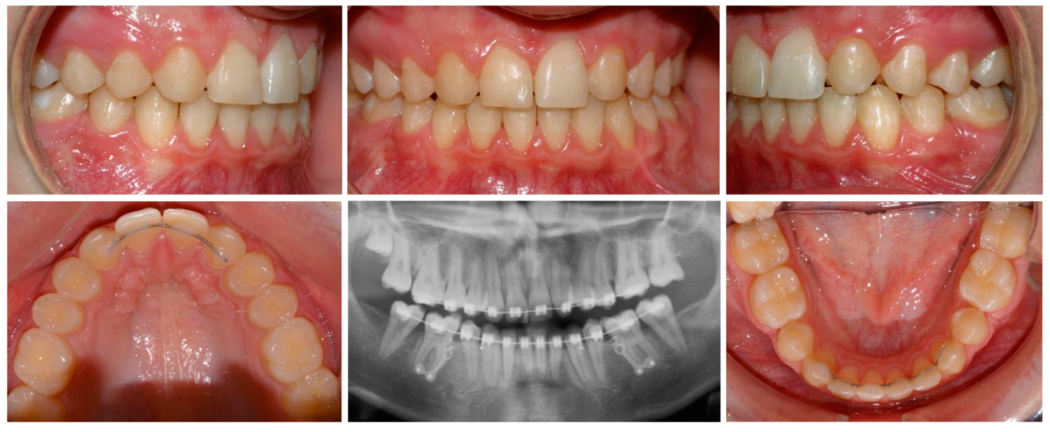 Applsci 12 12252 g005