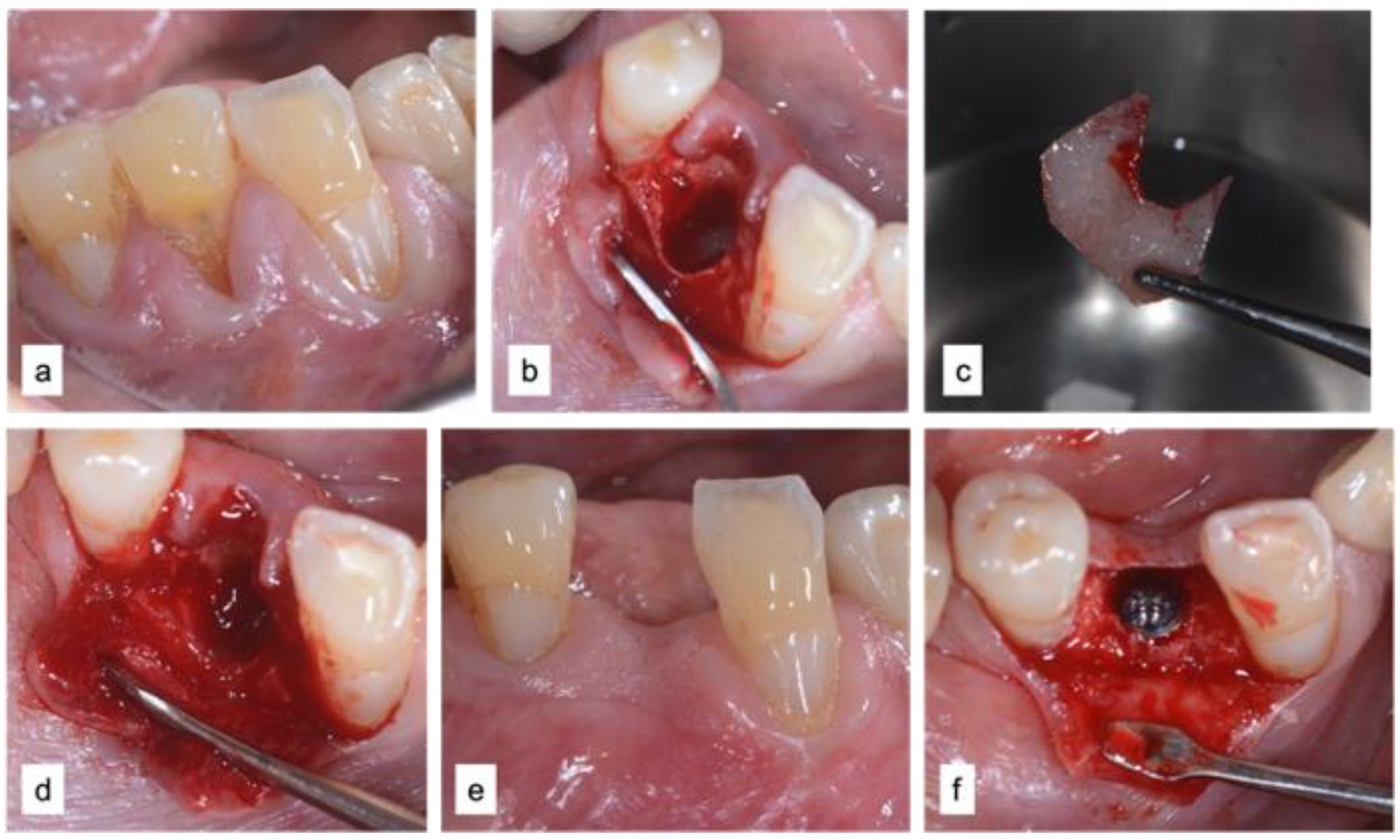 Applsci 12 12292 g003