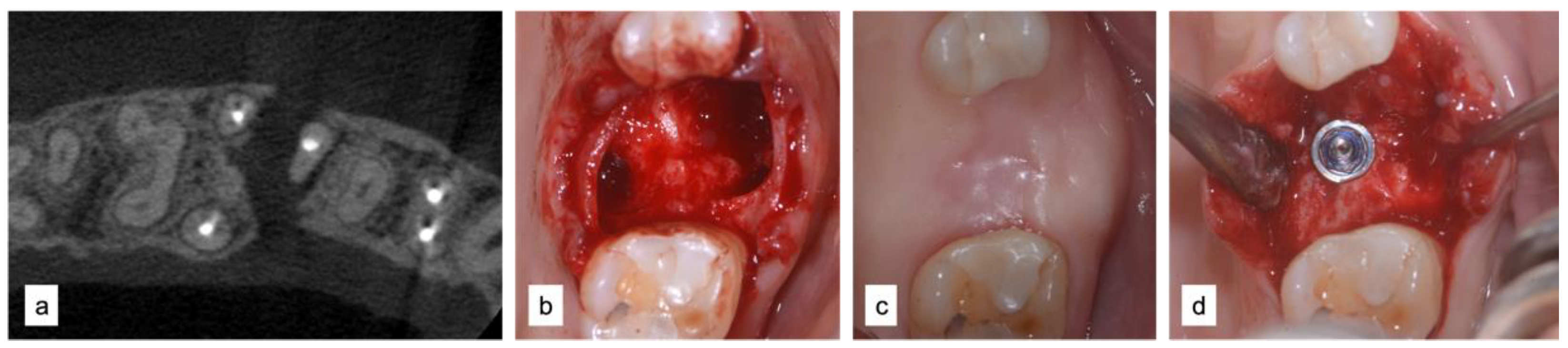 Applsci 12 12292 g004